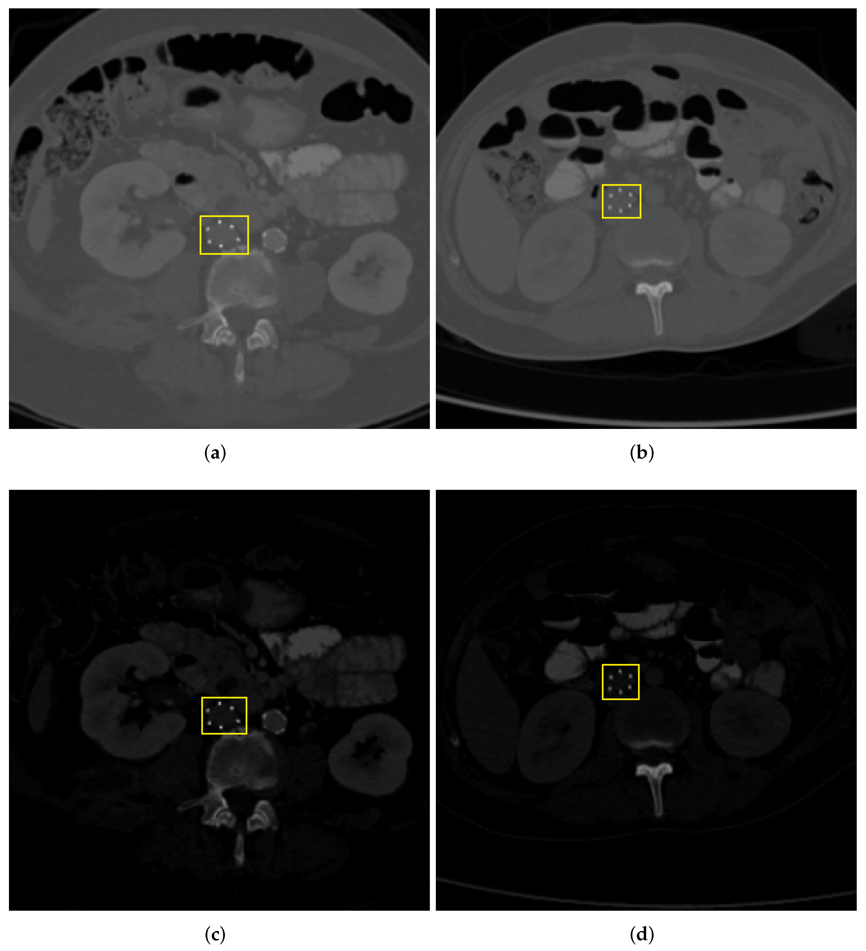 Diagnostics 12 02475 g004 Diagnostics 12 02475 g004