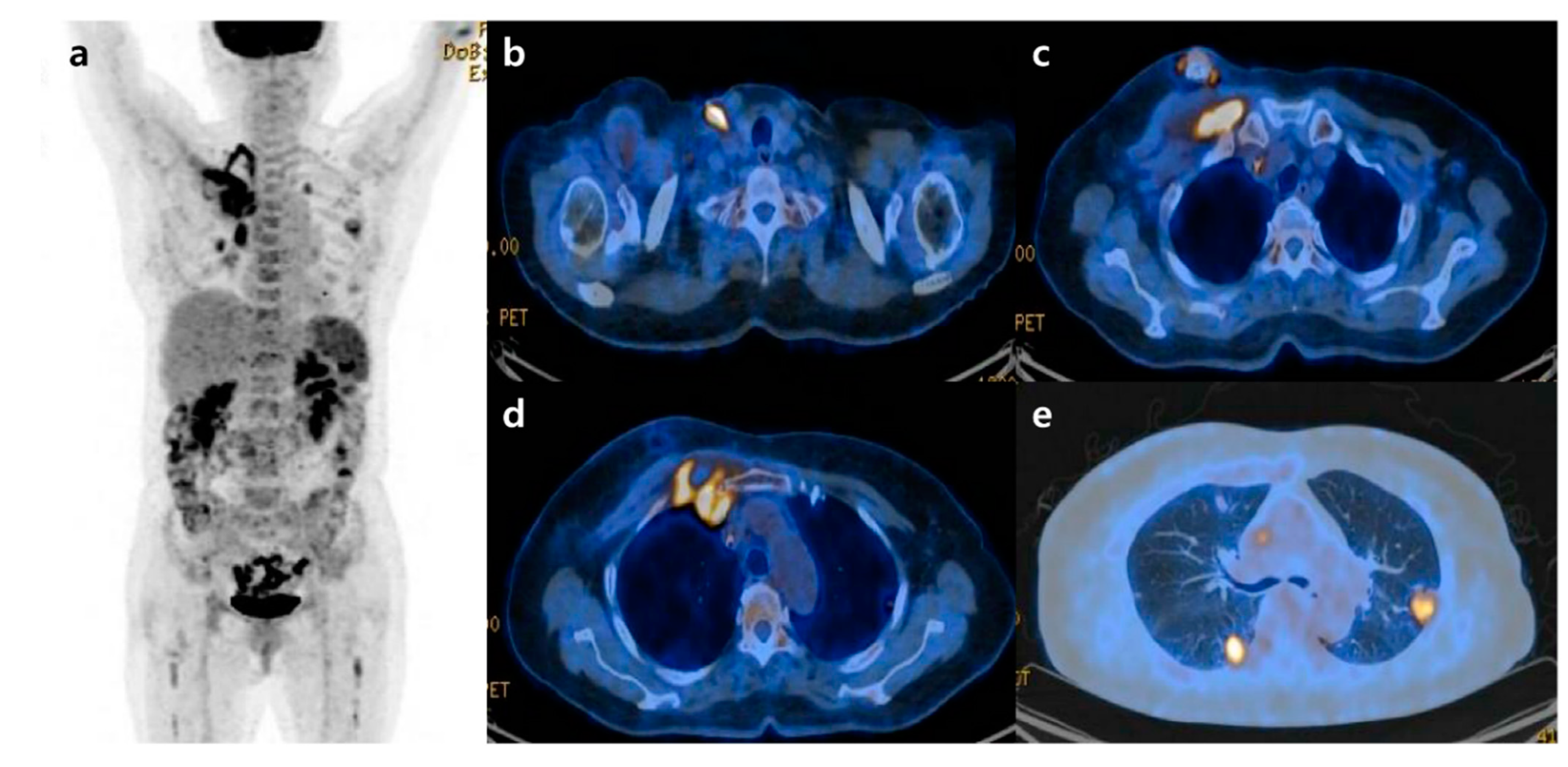 Diagnostics 12 02479 g002 Diagnostics 12 02479 g002