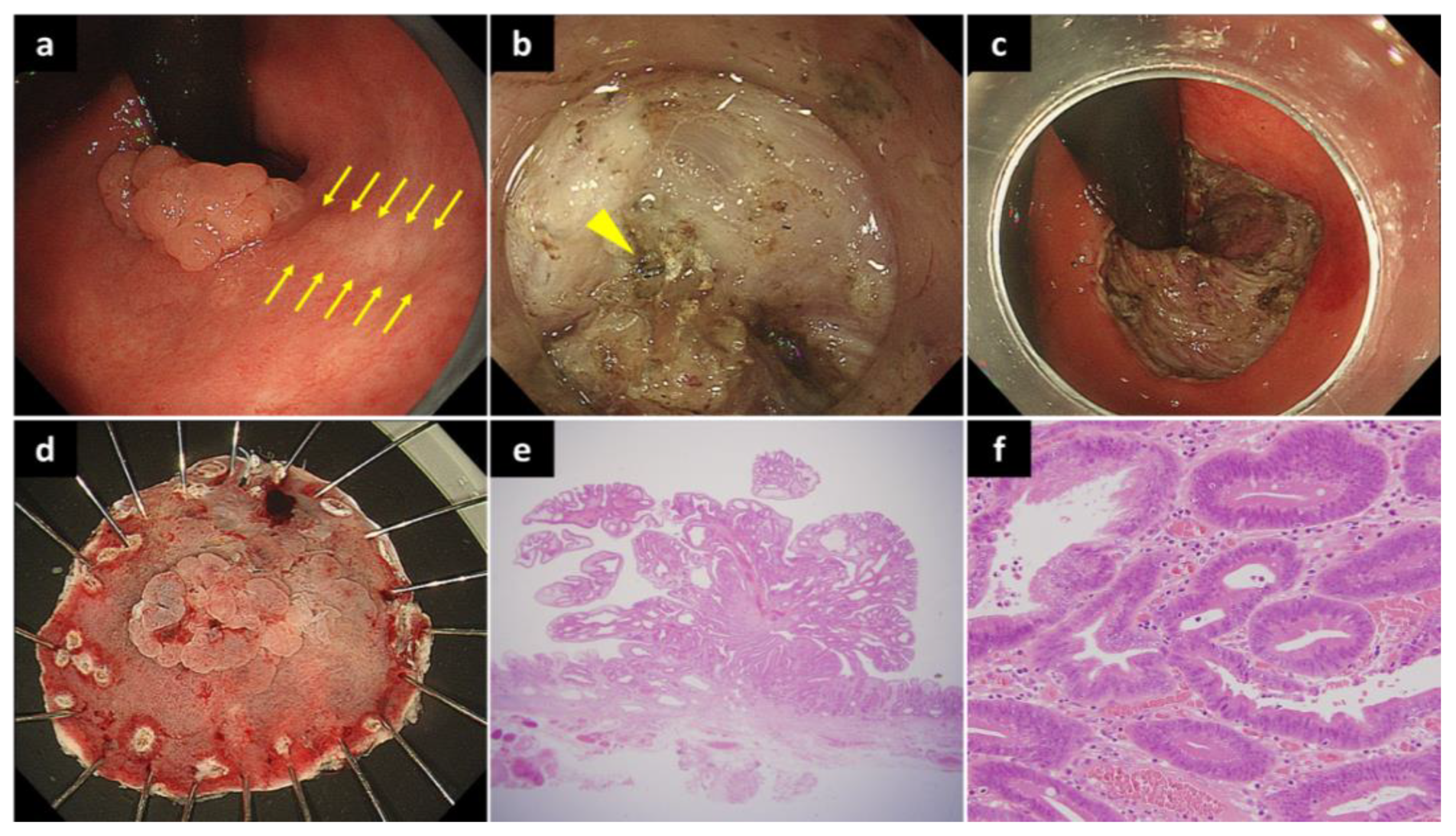 Diagnostics 12 02480 g001 Diagnostics 12 02480 g001