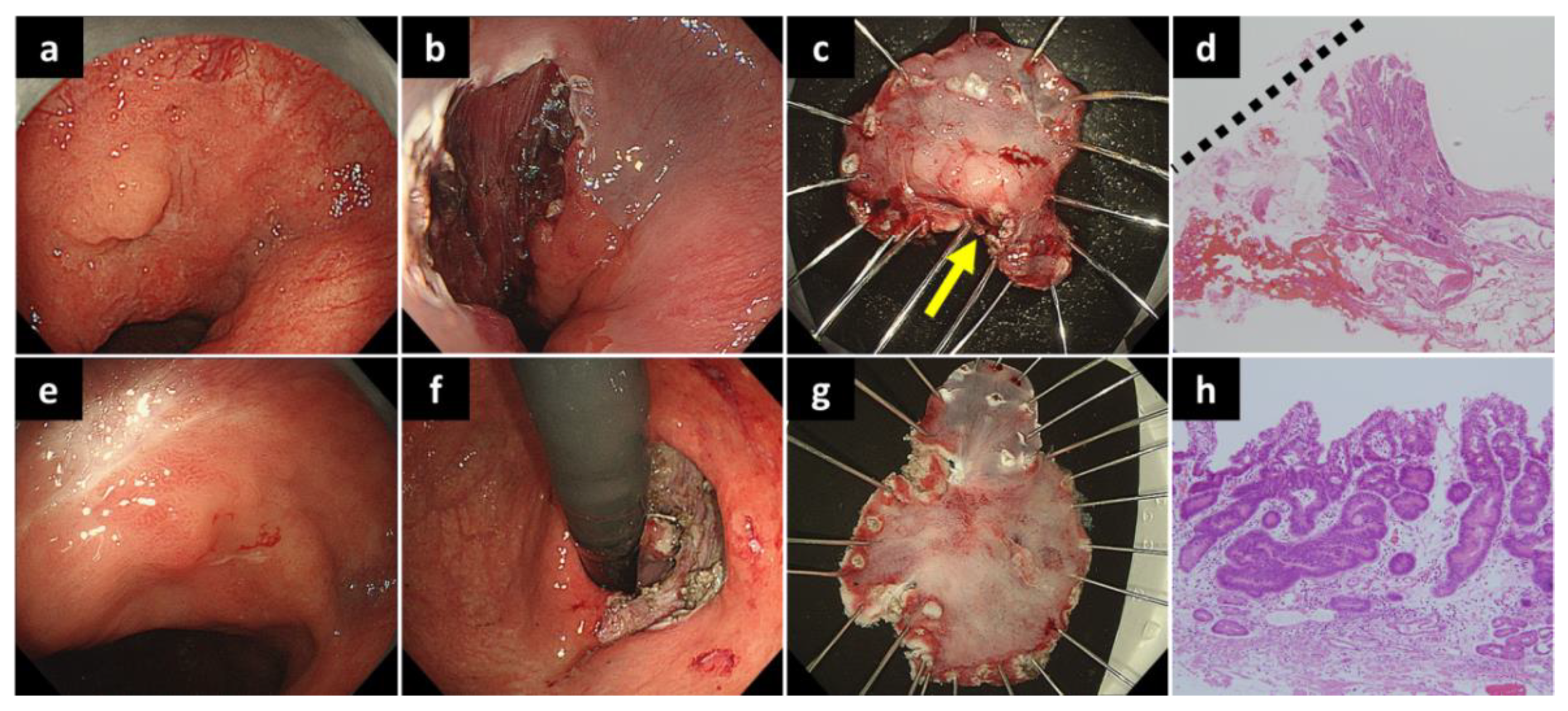 Diagnostics 12 02480 g003 Diagnostics 12 02480 g003