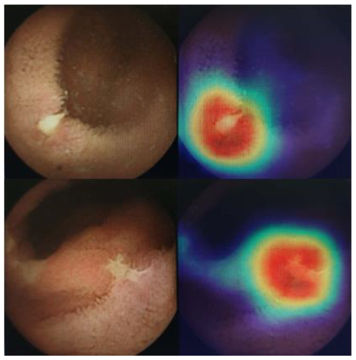 Diagnostics 12 02490 g006 Diagnostics 12 02490 g006