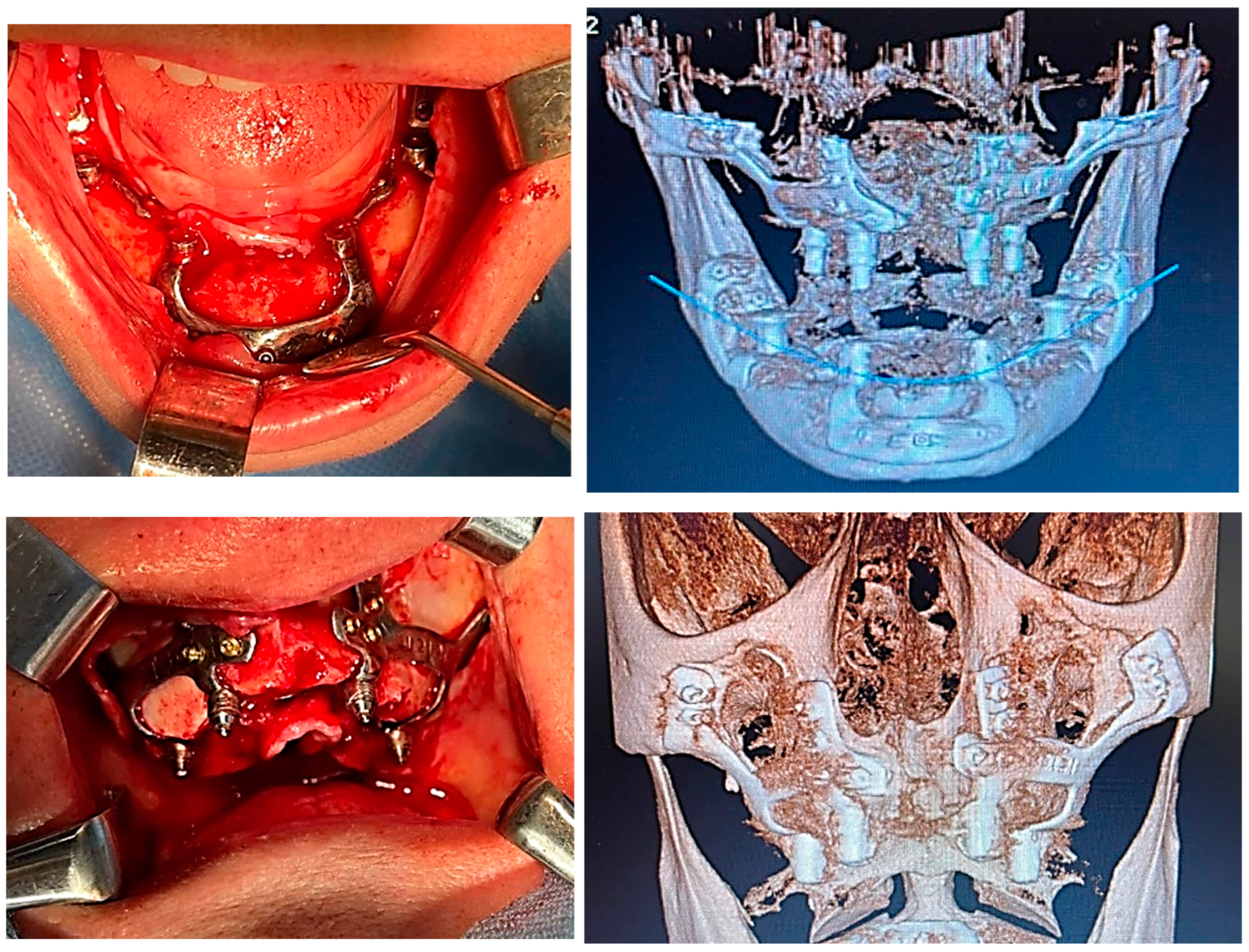 Diagnostics 12 02531 g006 Diagnostics 12 02531 g006