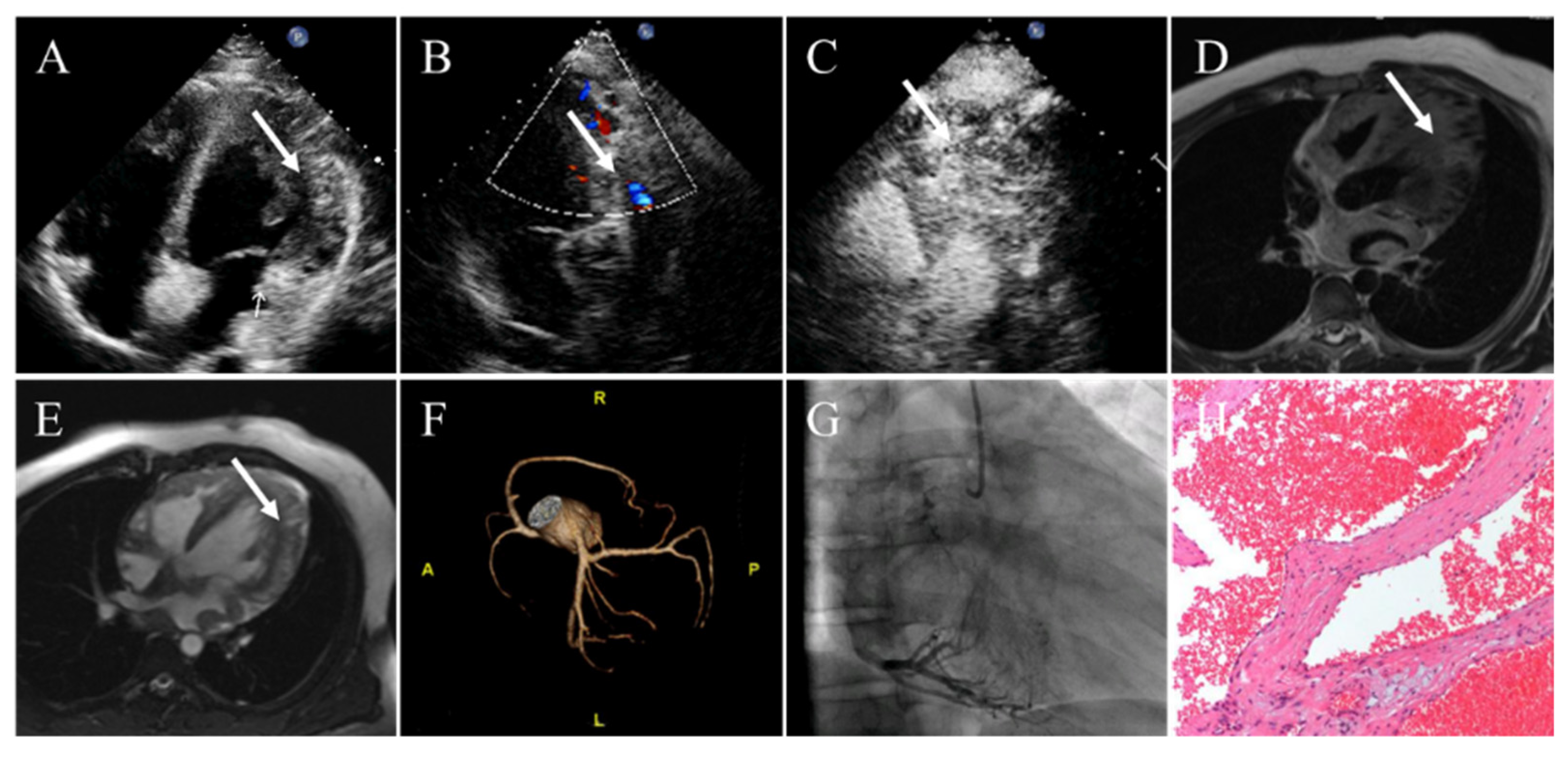 Diagnostics 12 02543 g005 Diagnostics 12 02543 g005