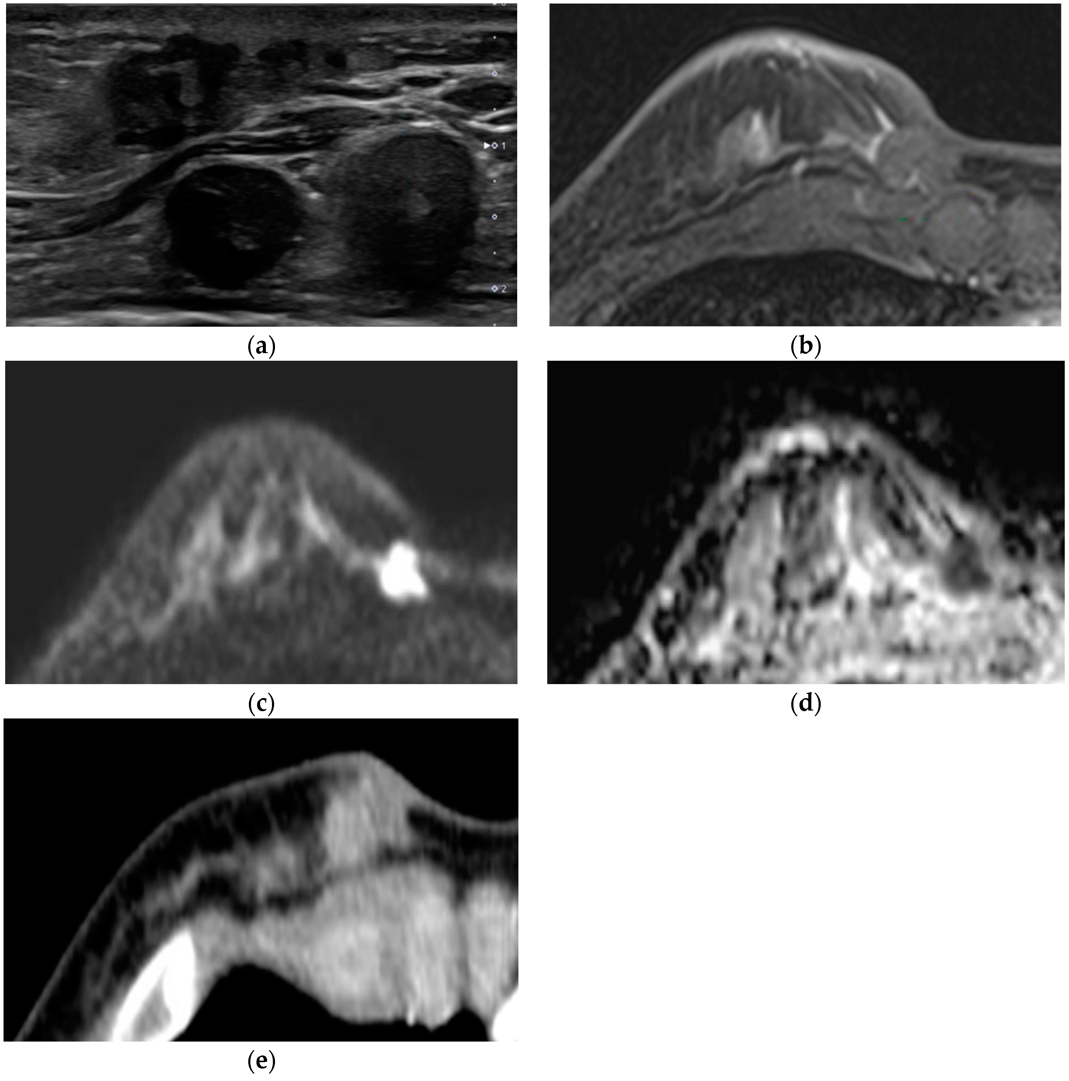 Diagnostics 12 02575 g002 Diagnostics 12 02575 g002