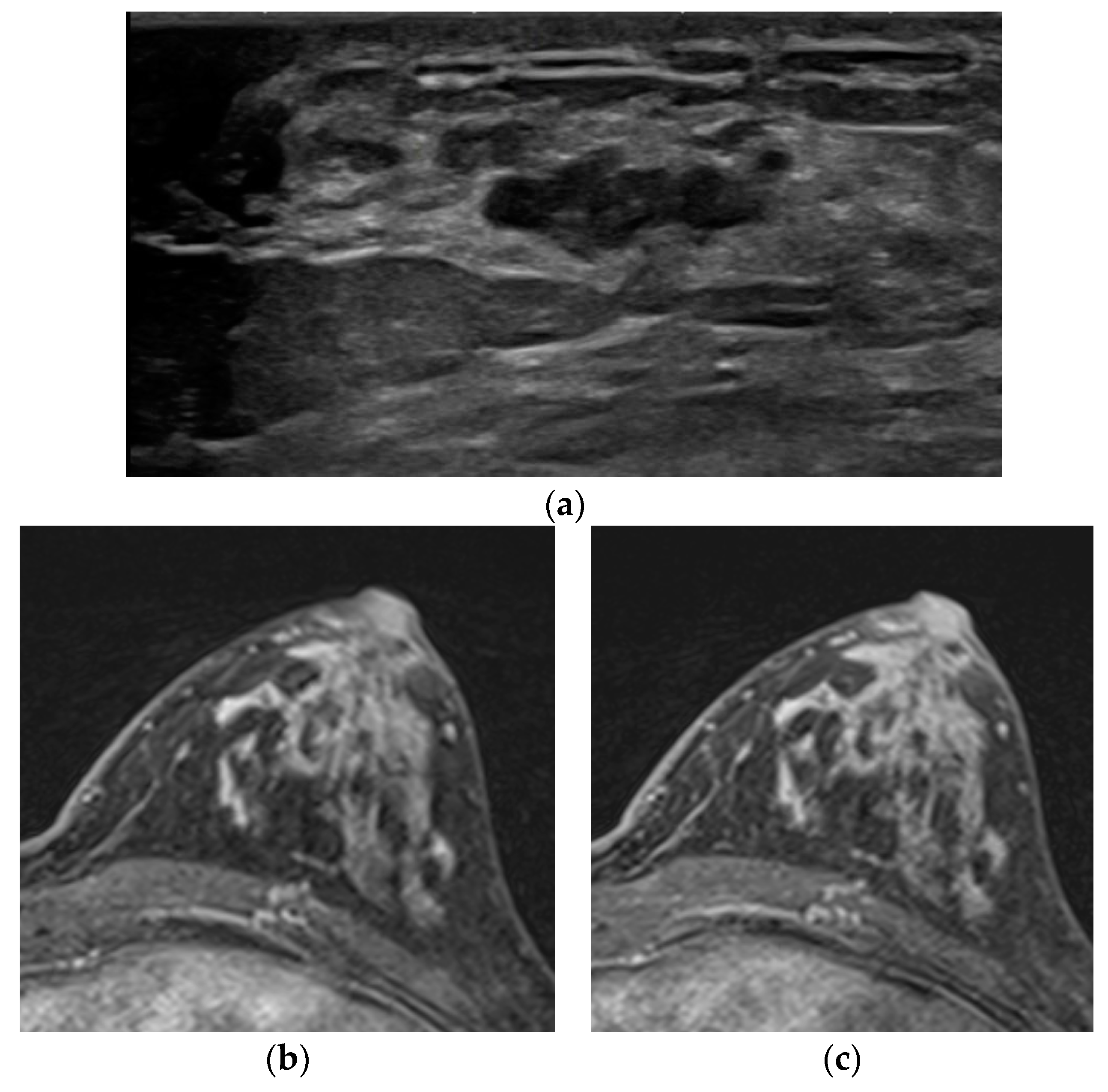 Diagnostics 12 02575 g003 Diagnostics 12 02575 g003