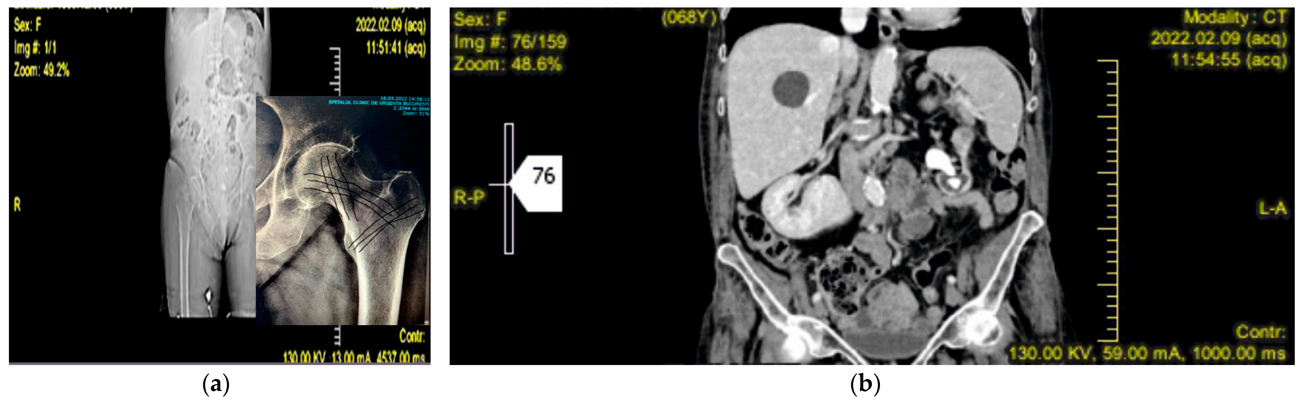 Diagnostics 12 02592 g001 Diagnostics 12 02592 g001