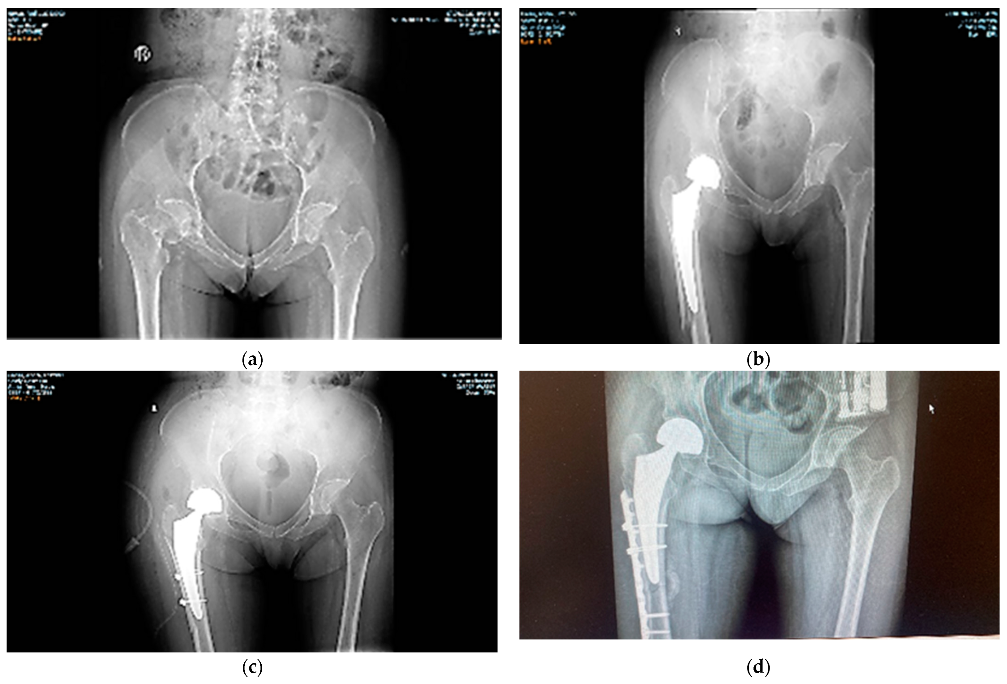 Diagnostics 12 02592 g004 Diagnostics 12 02592 g004