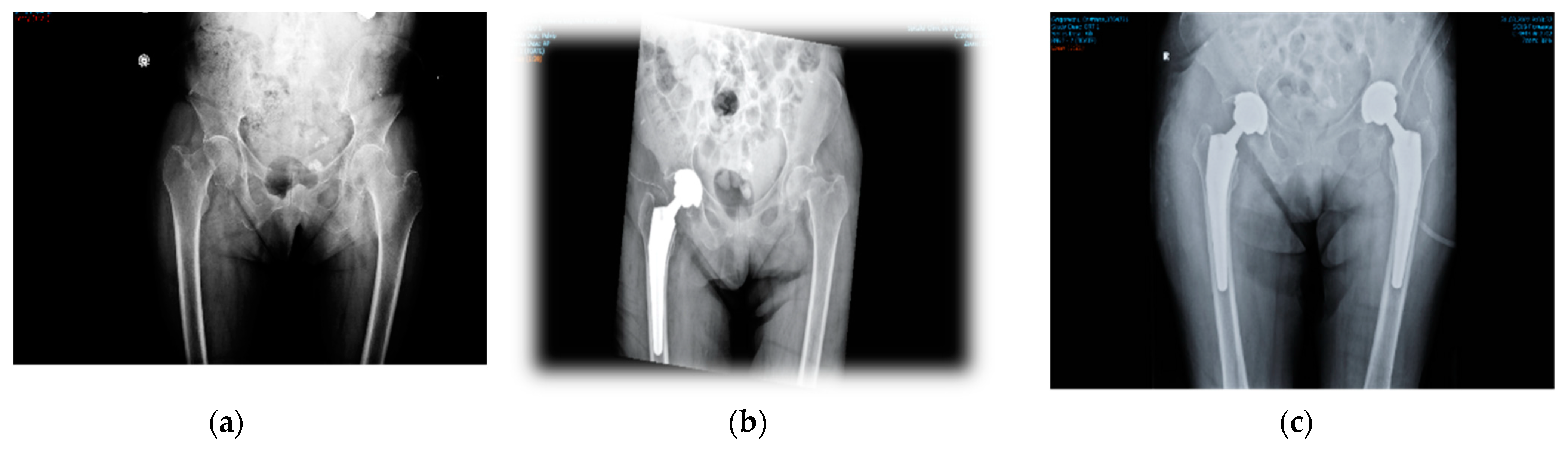 Diagnostics 12 02592 g005 Diagnostics 12 02592 g005