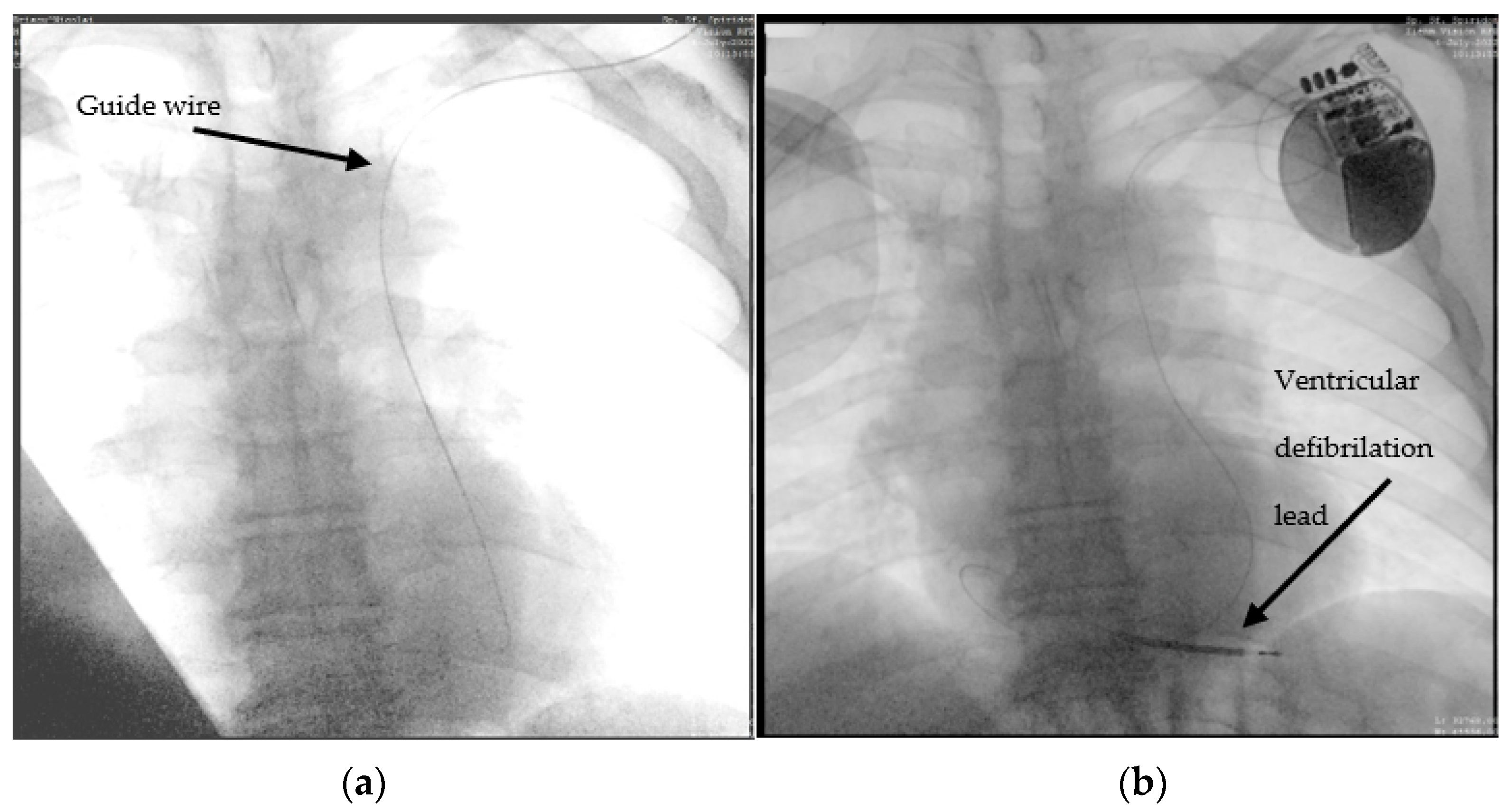 Diagnostics 12 02596 g002