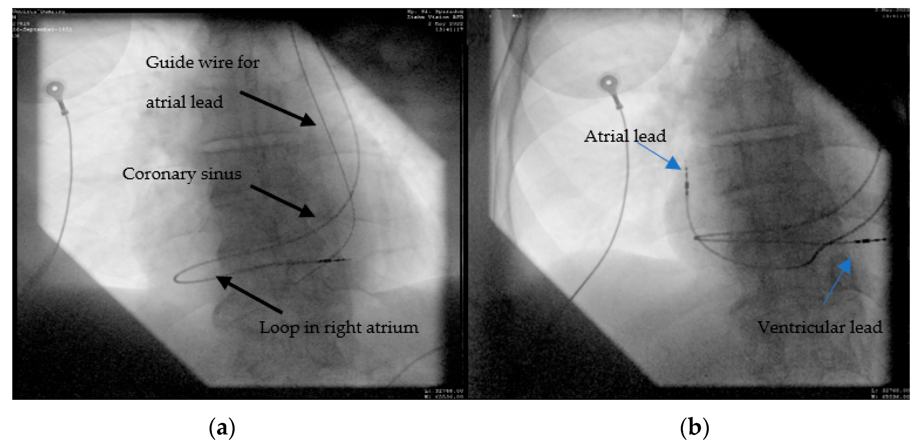 Diagnostics 12 02596 g005