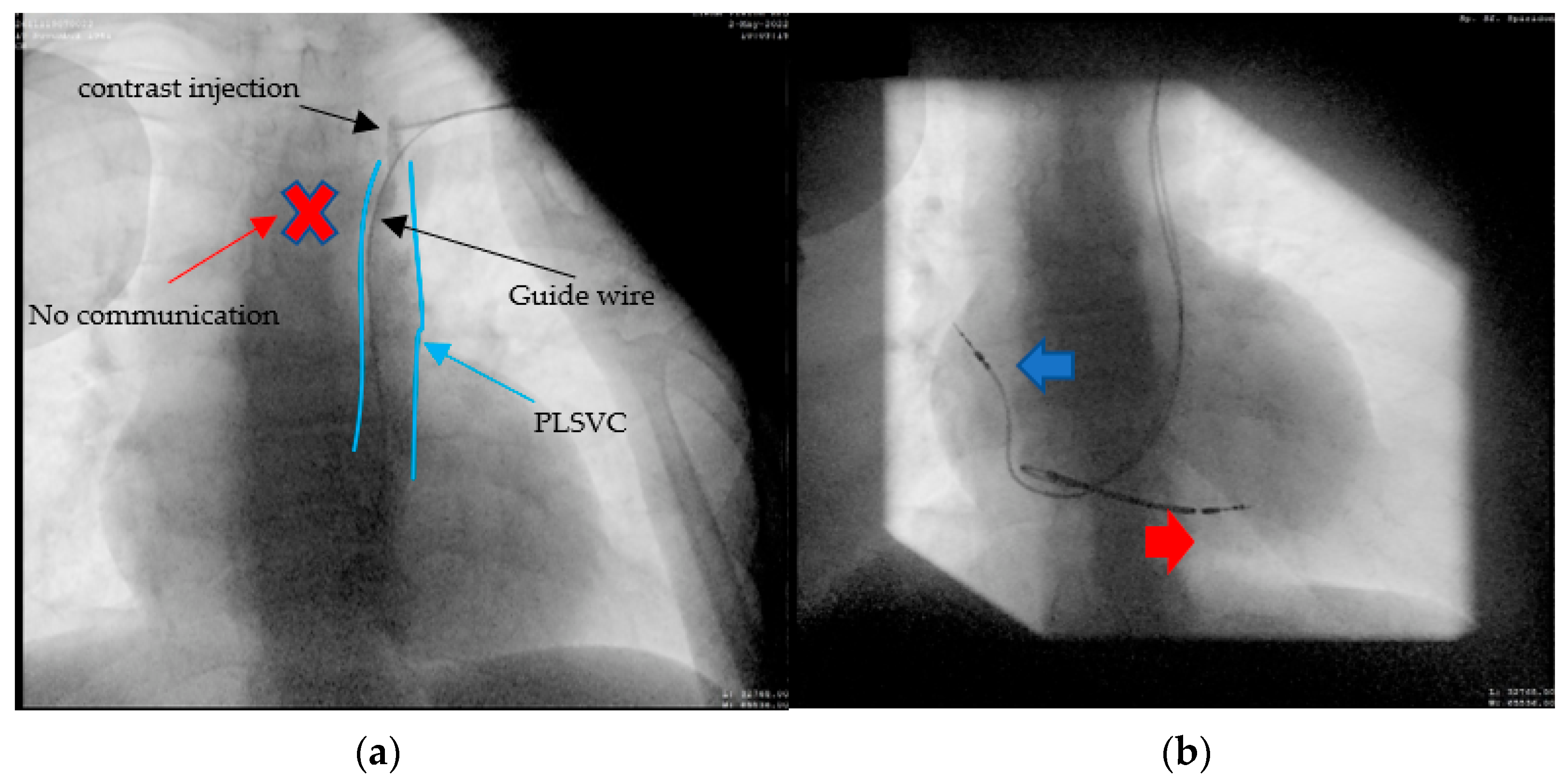 Diagnostics 12 02596 g006