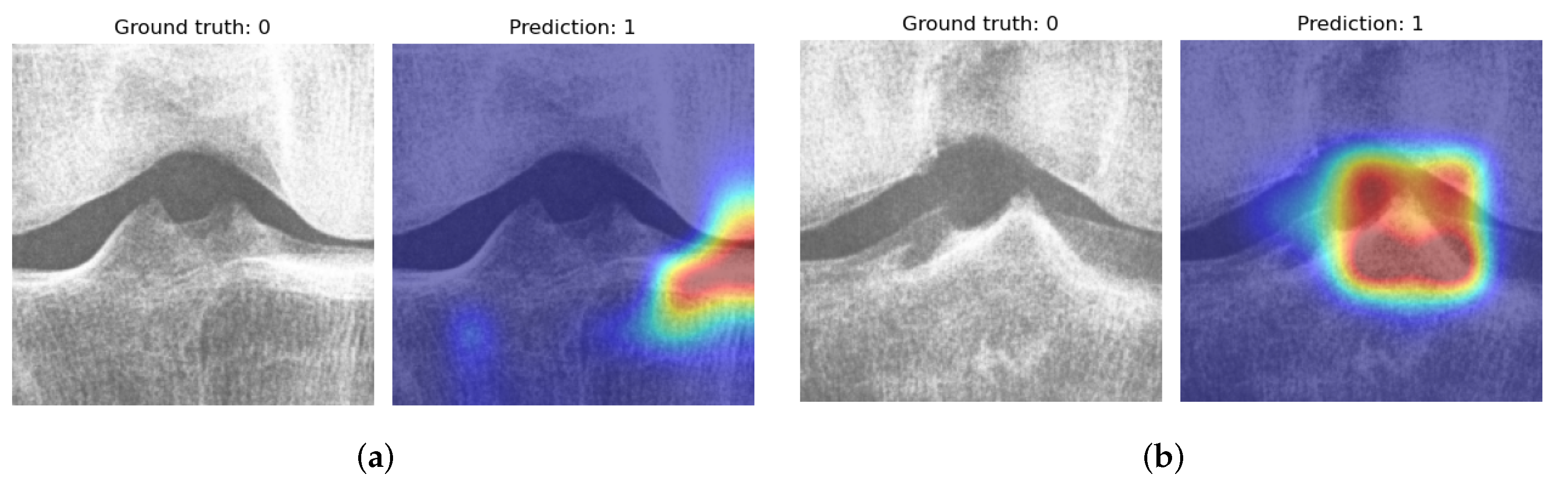 Diagnostics 12 02603 g005 Diagnostics 12 02603 g005