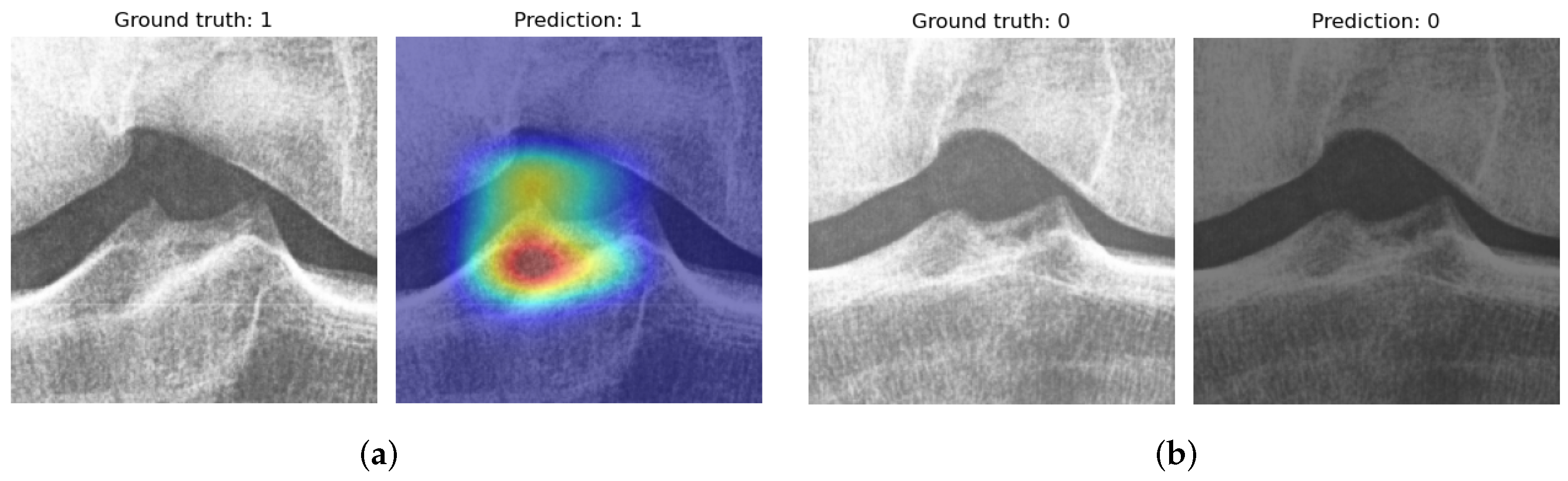 Diagnostics 12 02603 g006 Diagnostics 12 02603 g006