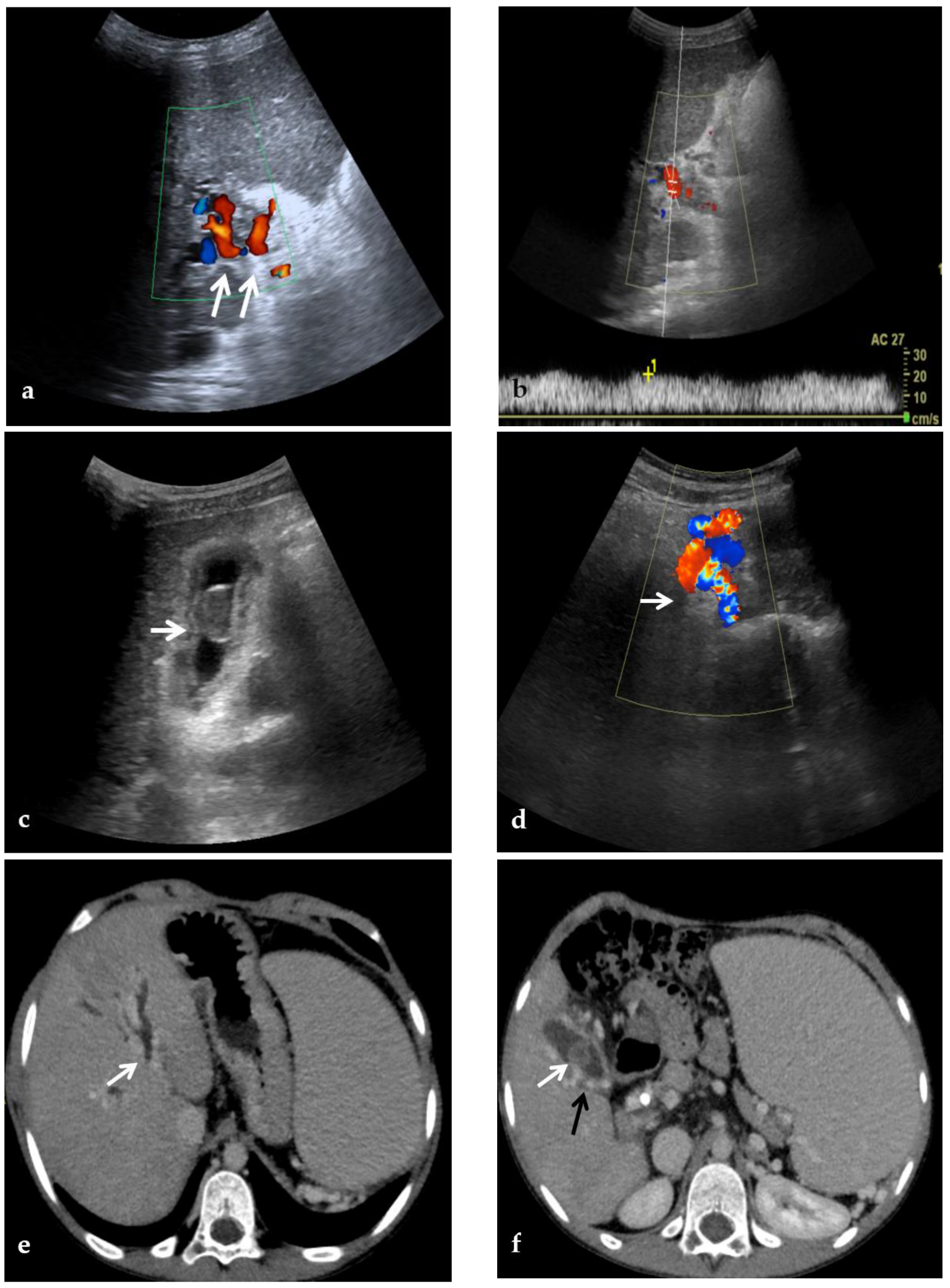 Diagnostics 12 02628 g002a