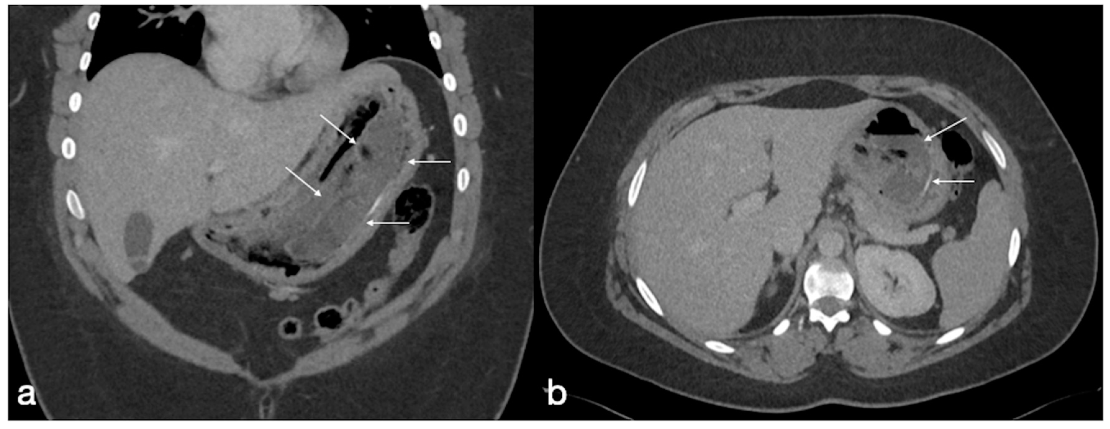 Diagnostics 12 02637 g007