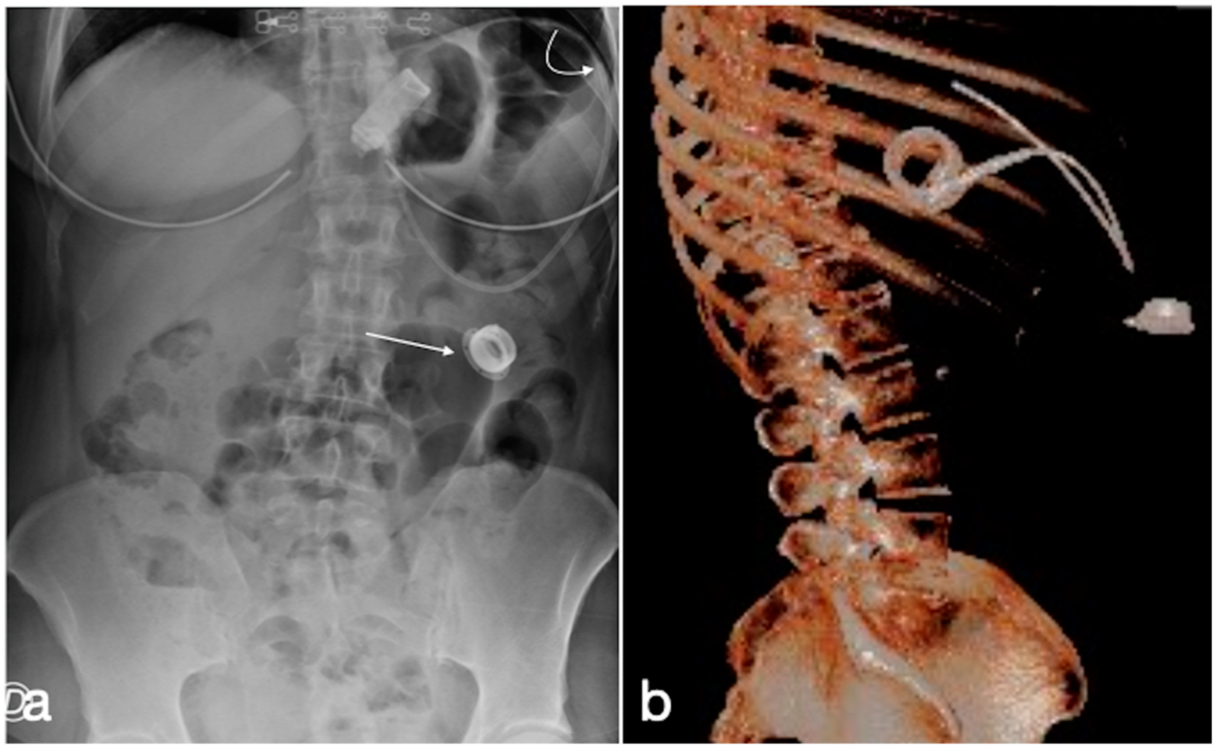 Diagnostics 12 02637 g011