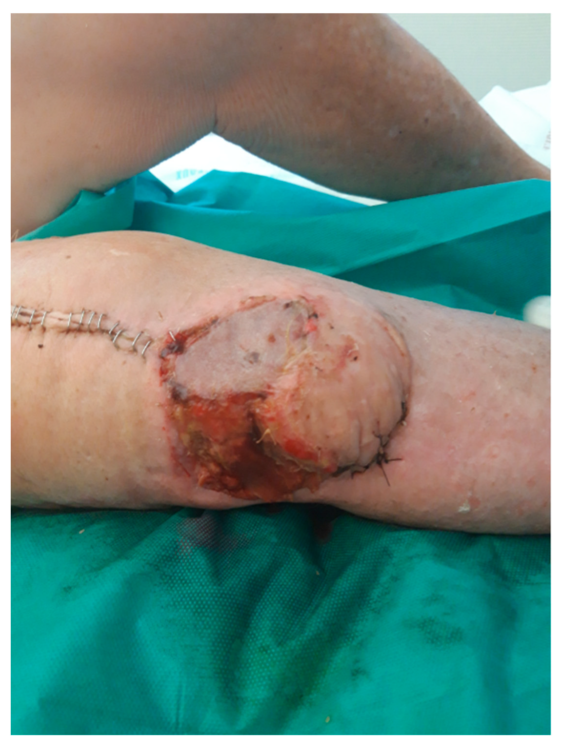 Diagnostics 12 02640 g002 Diagnostics 12 02640 g002