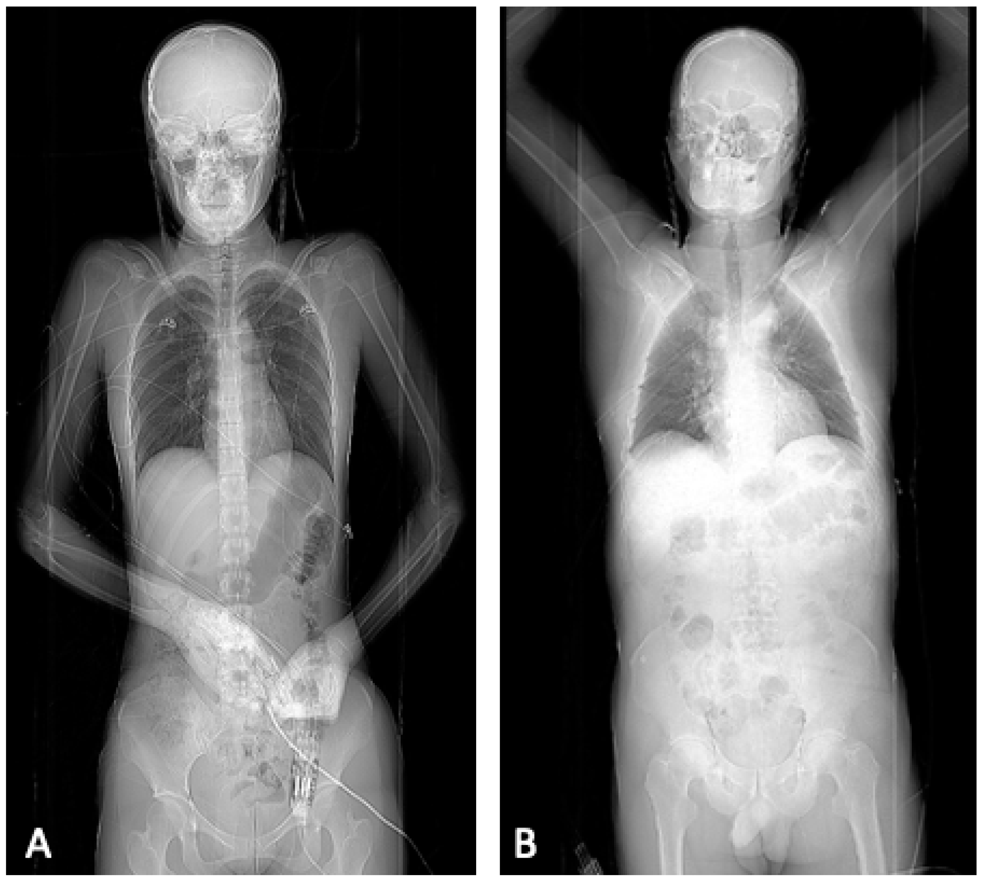 Diagnostics 12 02661 g001 Diagnostics 12 02661 g001