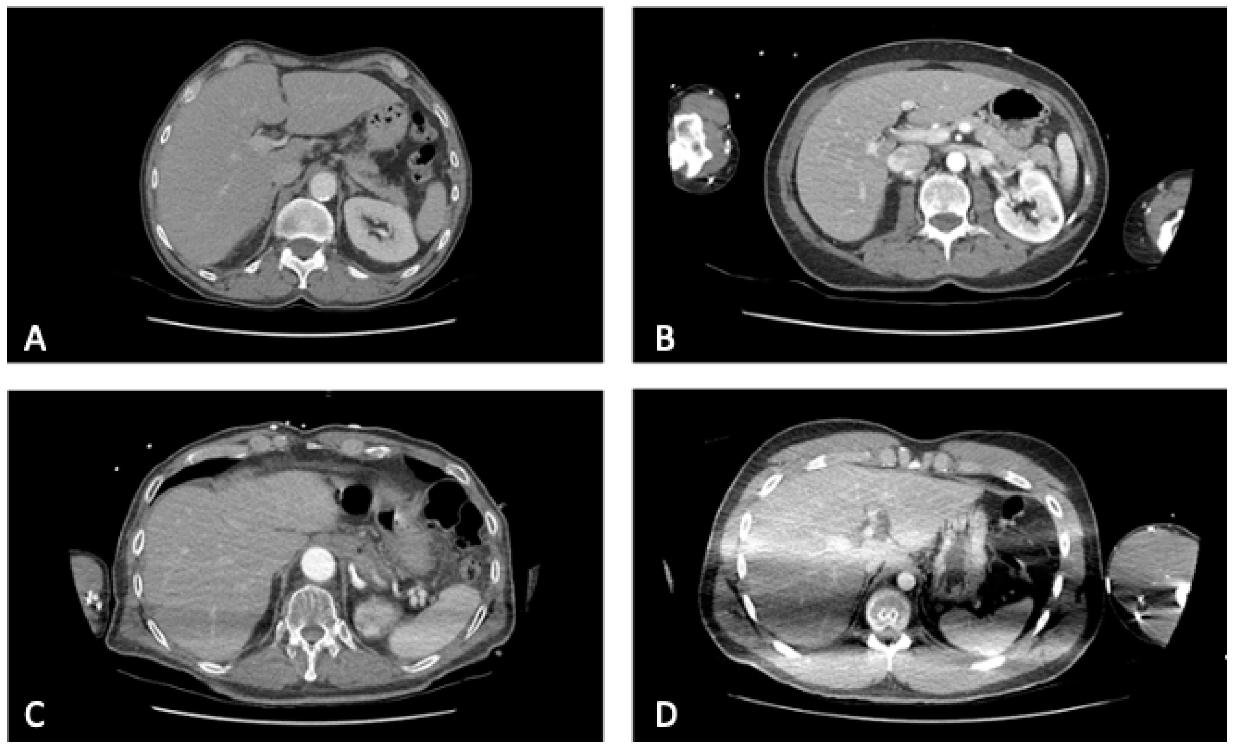 Diagnostics 12 02661 g002 Diagnostics 12 02661 g002