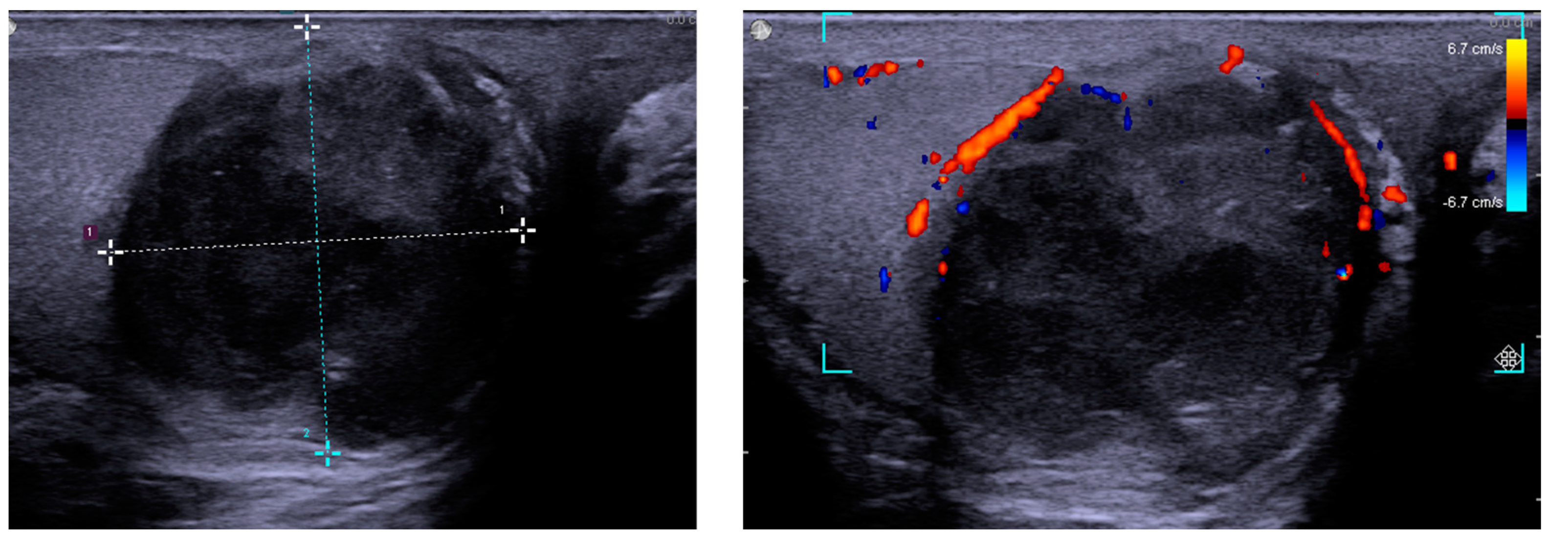 Diagnostics 12 02663 g002 Diagnostics 12 02663 g002