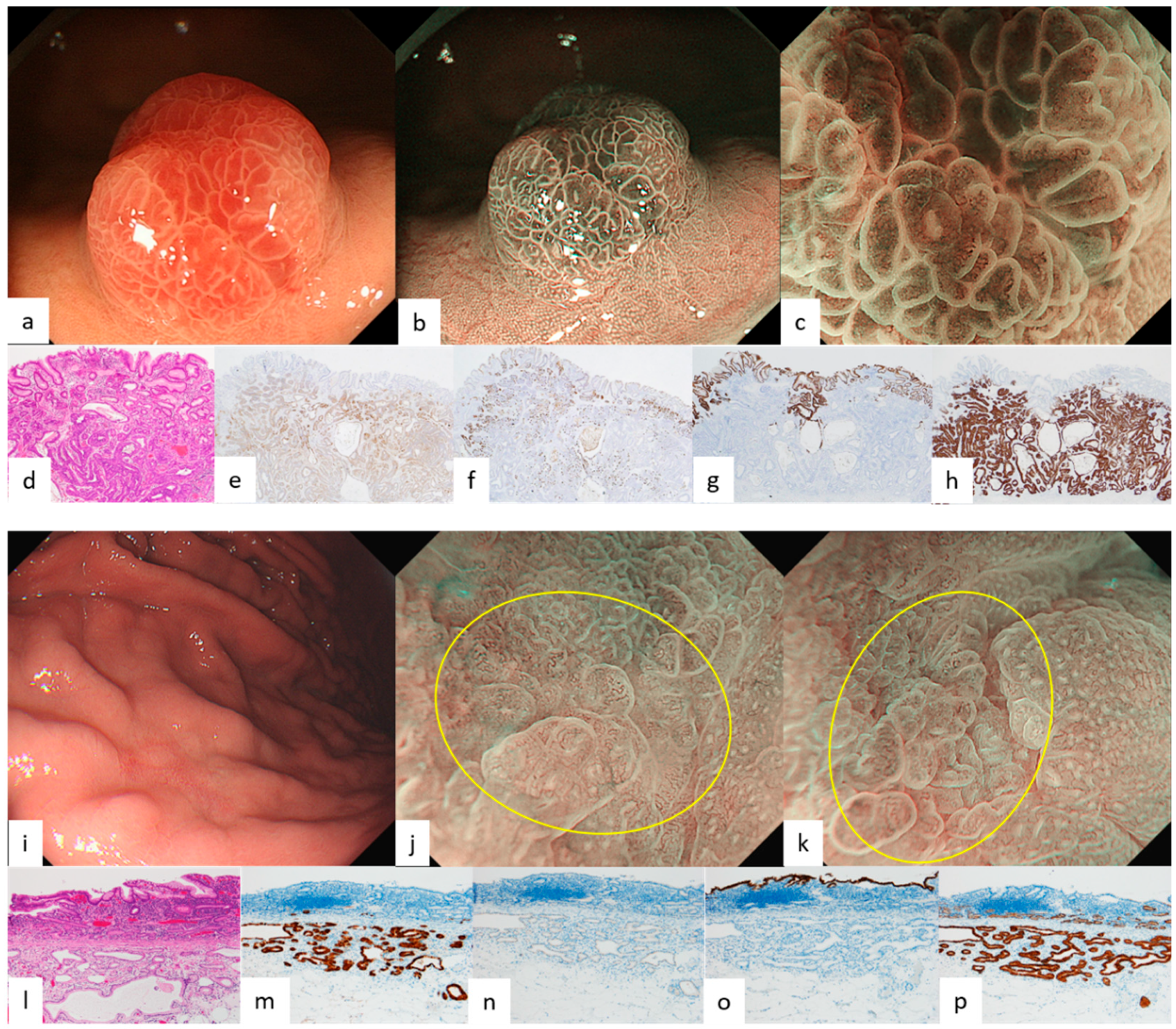 Diagnostics 12 02666 g002 Diagnostics 12 02666 g002