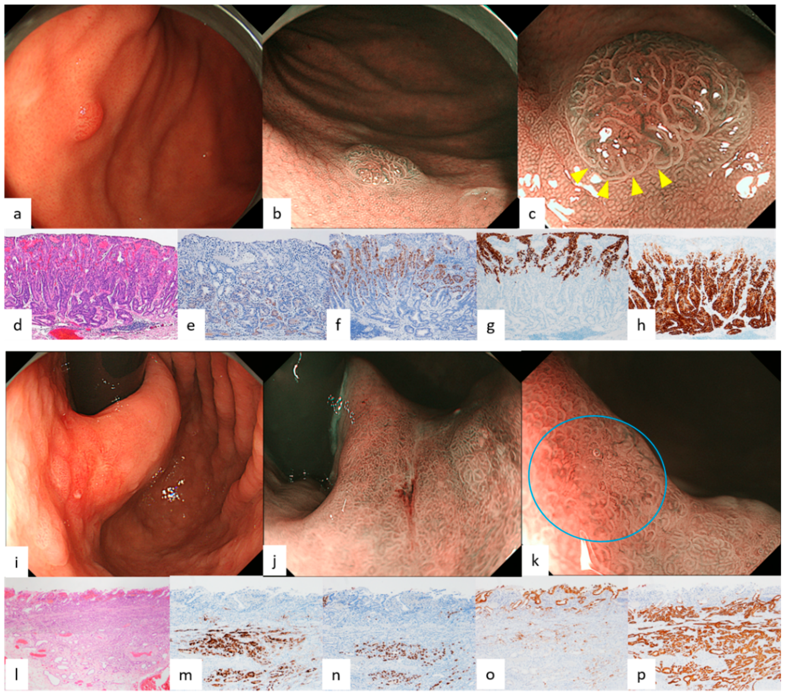 Diagnostics 12 02666 g004 Diagnostics 12 02666 g004