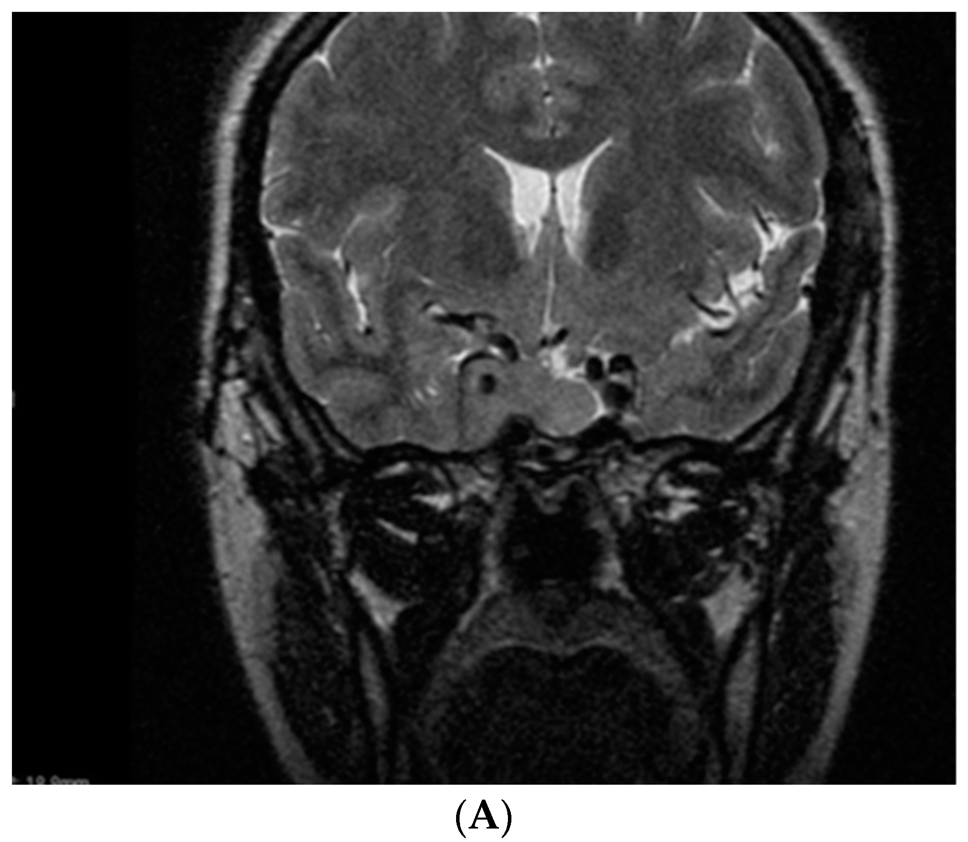 Diagnostics 12 02669 g003a Diagnostics 12 02669 g003a