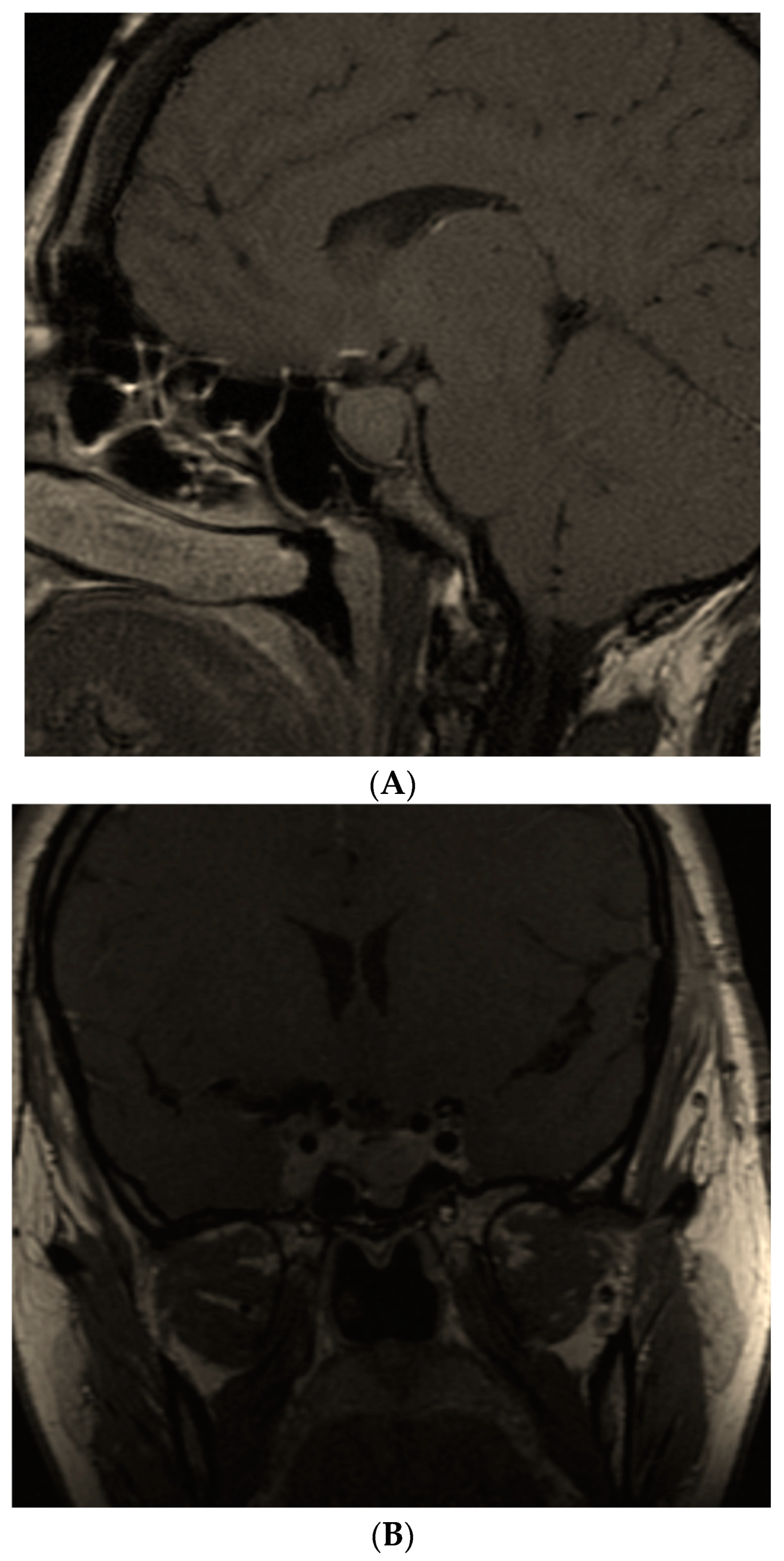 Diagnostics 12 02669 g004a Diagnostics 12 02669 g004a