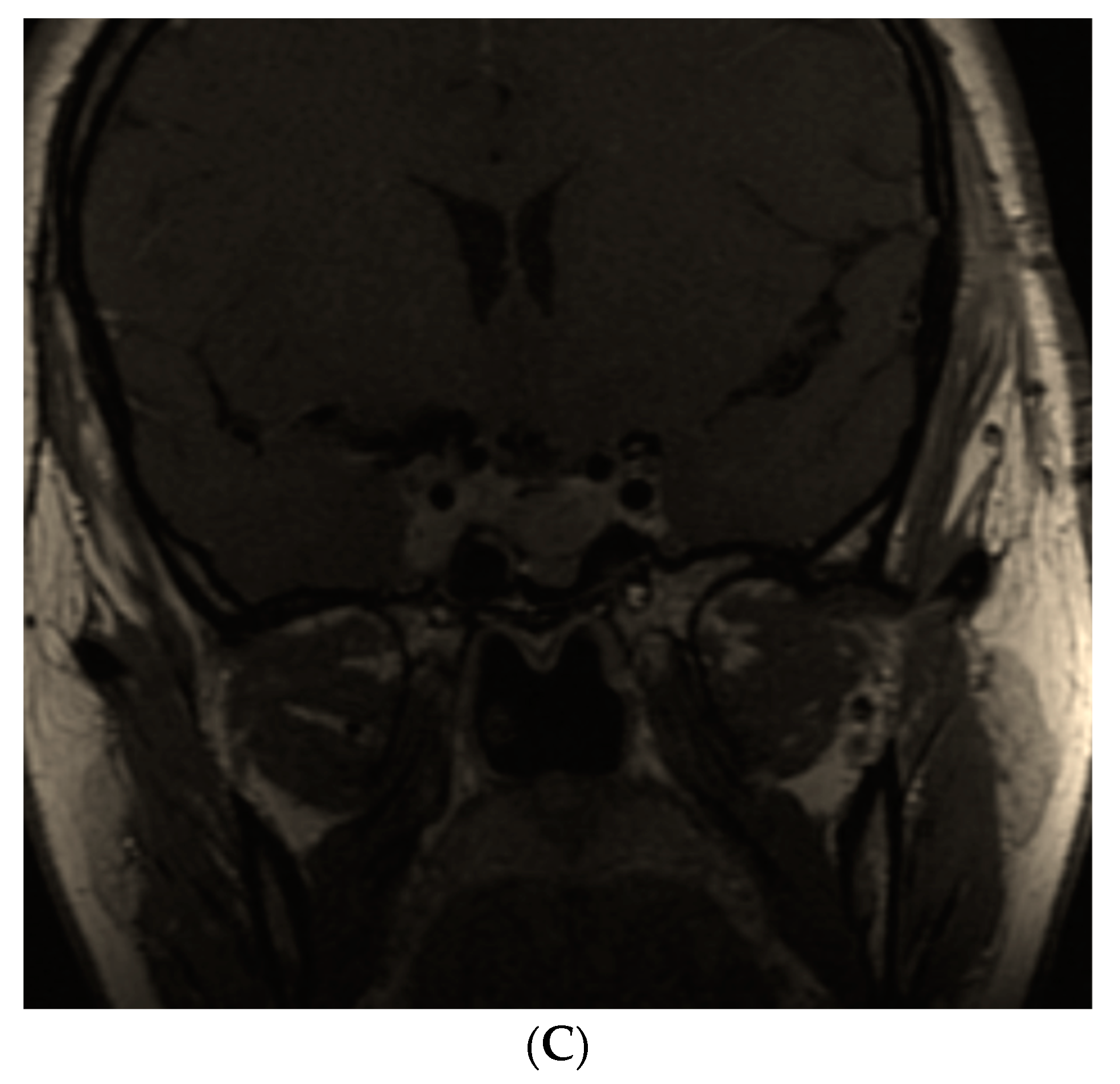 Diagnostics 12 02669 g004b Diagnostics 12 02669 g004b