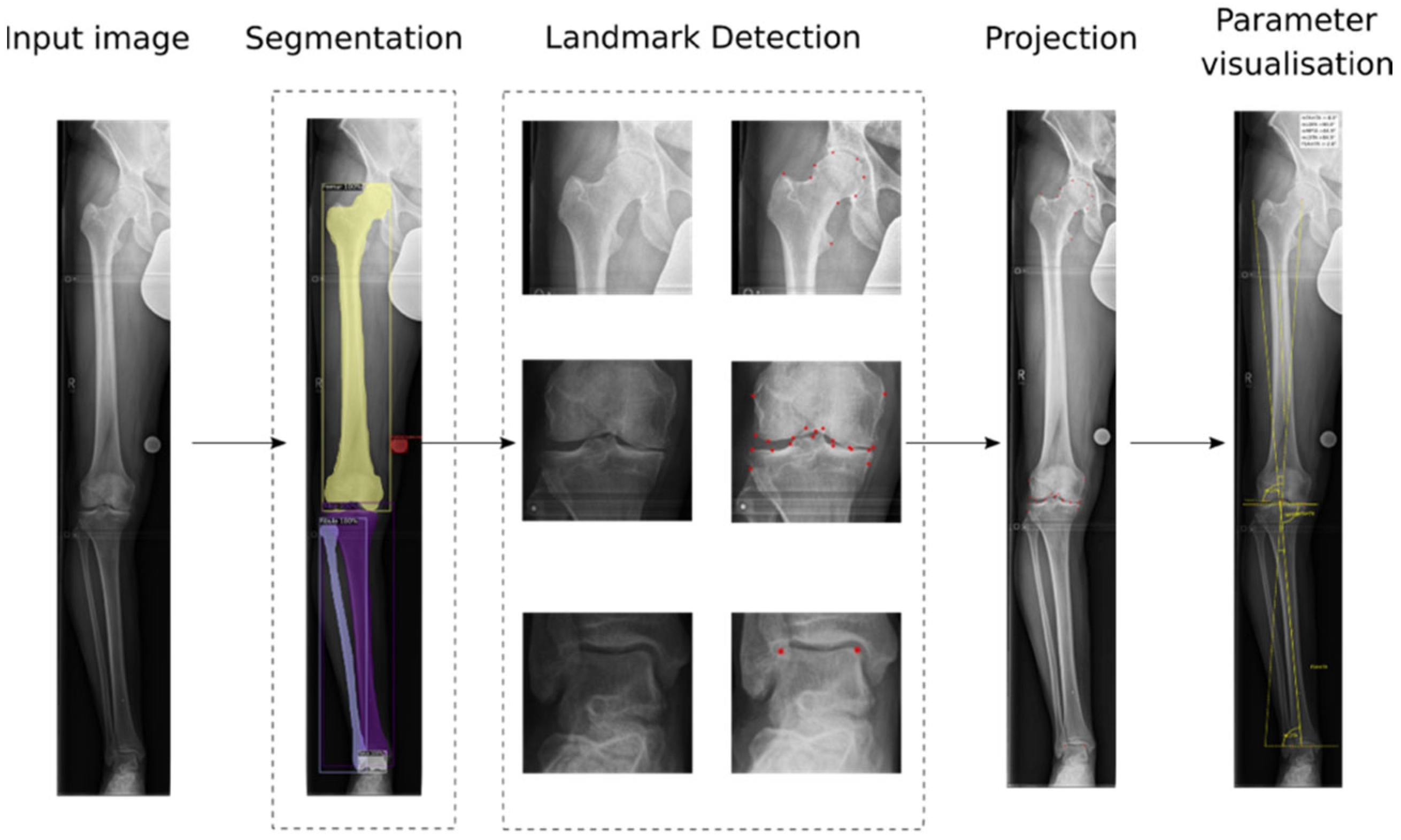 Automated Artificial Intelligence-Based Assessment of Lower