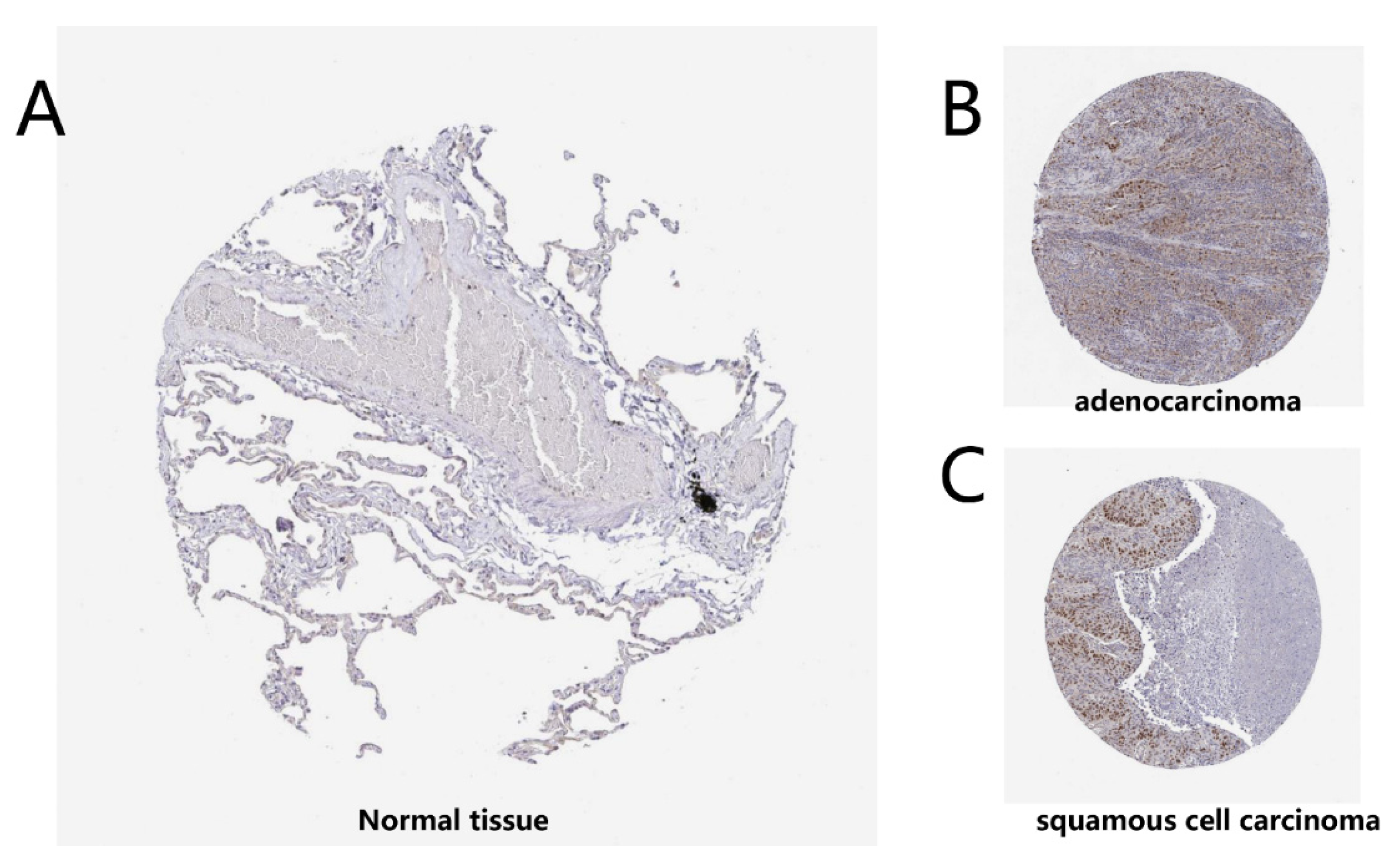 Diagnostics | Free Full-Text | Association of the Timeless Gene 