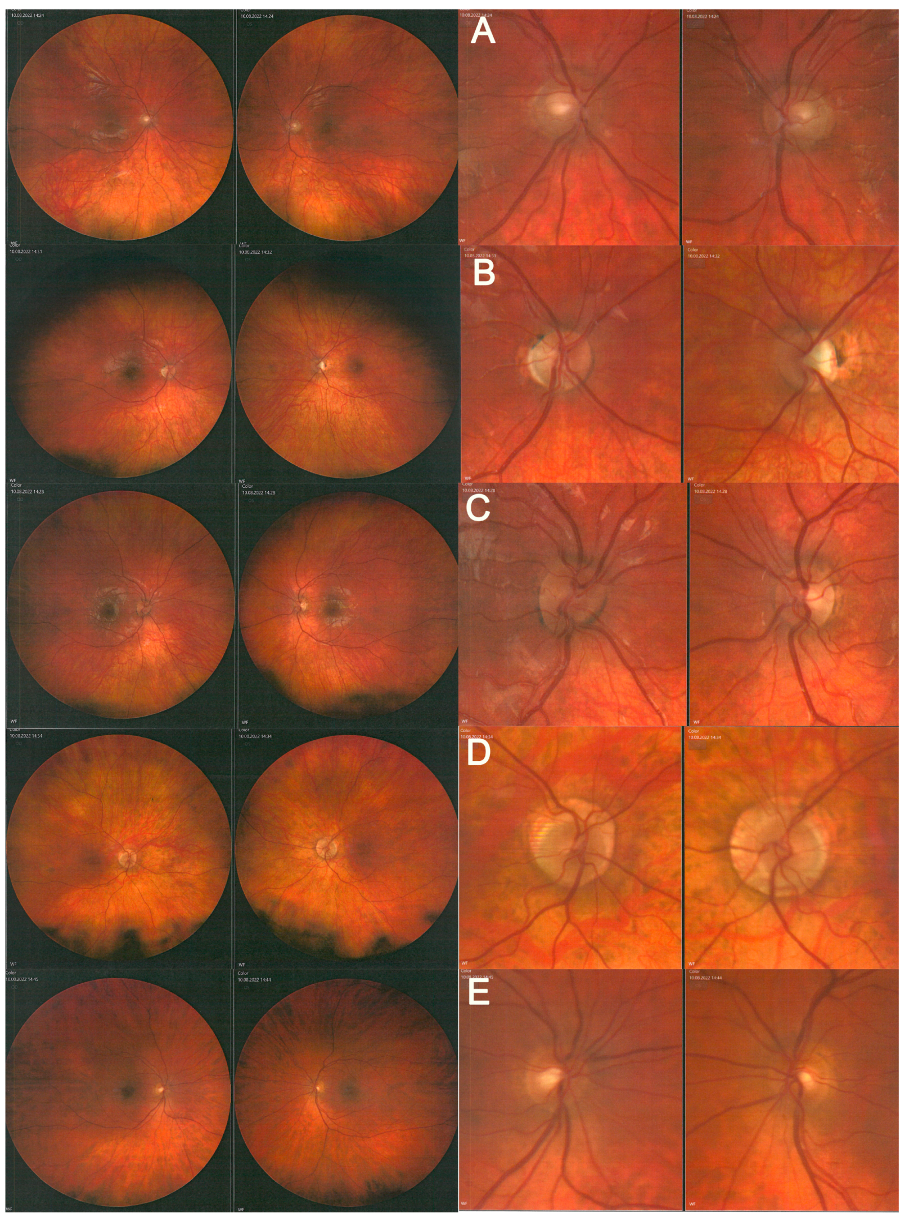 Diagnostics 12 02701 g004 Diagnostics 12 02701 g004