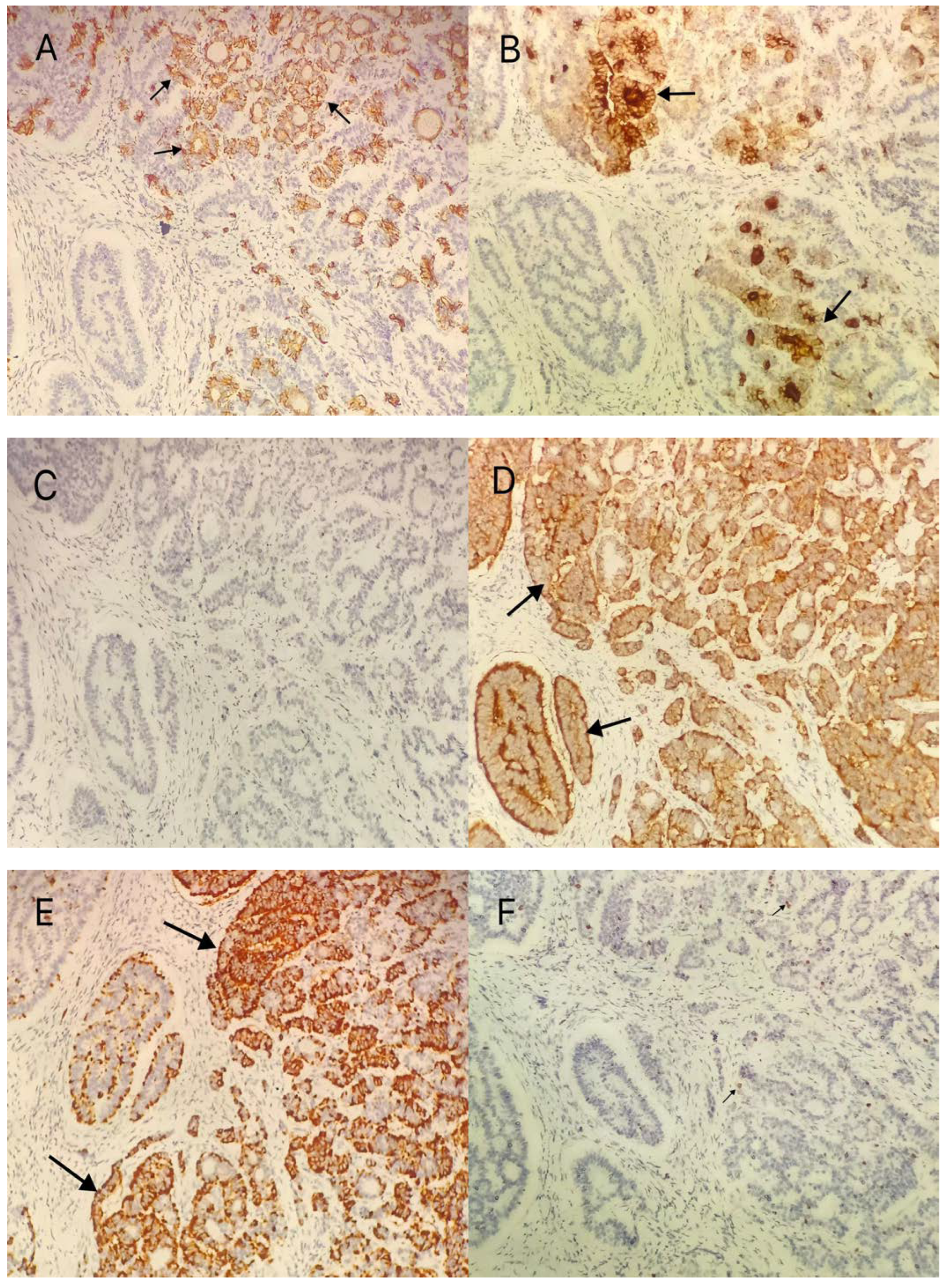 Diagnostics 12 02706 g004 Diagnostics 12 02706 g004