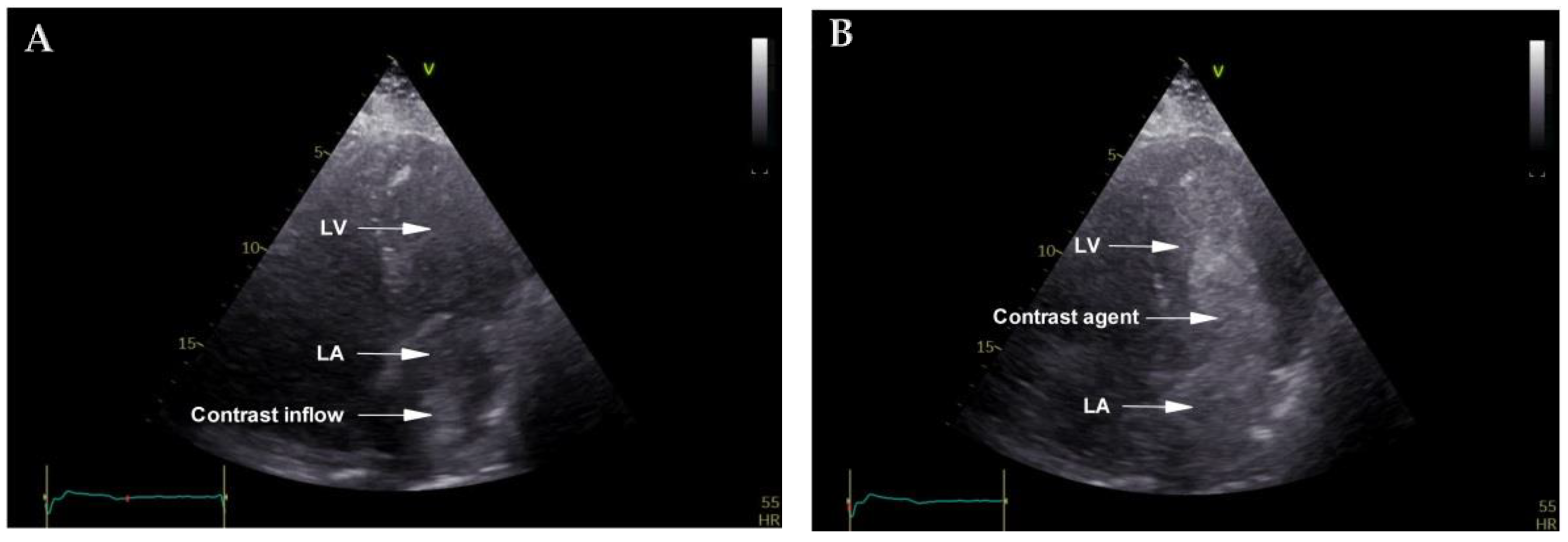 Diagnostics 12 02707 g002 Diagnostics 12 02707 g002