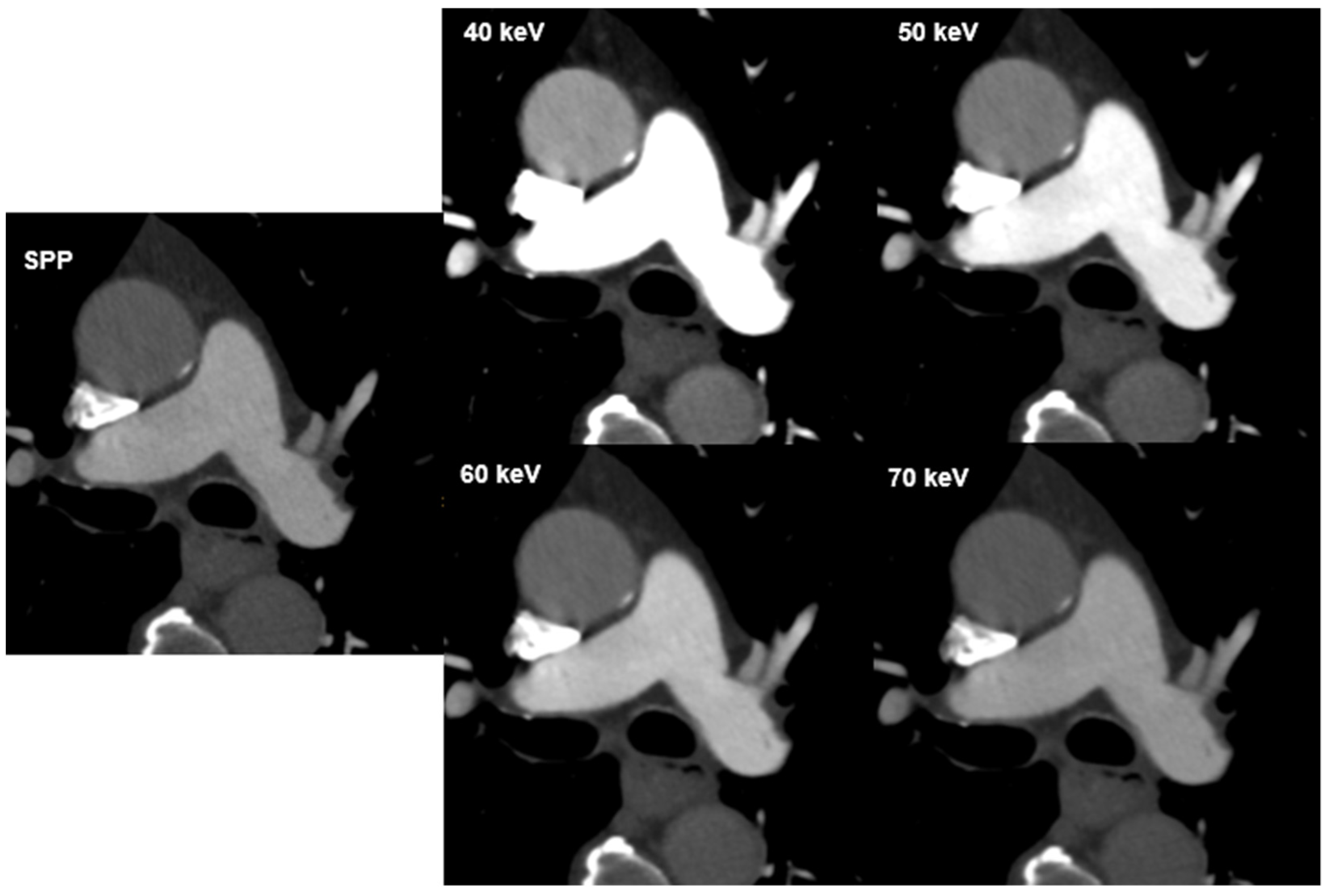 Diagnostics 12 02715 g002 Diagnostics 12 02715 g002