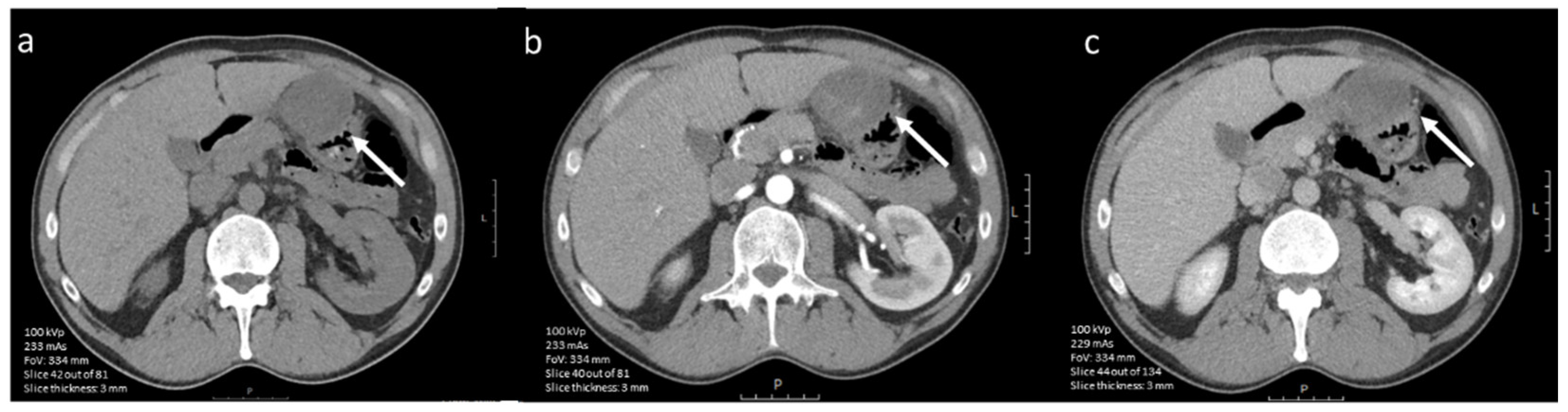 Diagnostics 12 02722 g003 Diagnostics 12 02722 g003