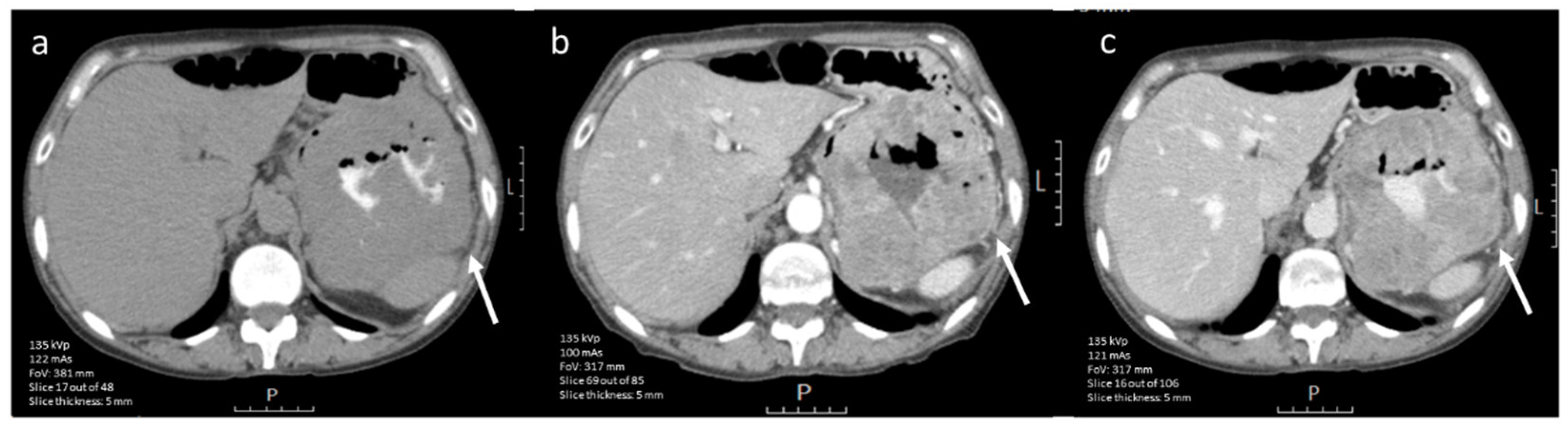 Diagnostics 12 02722 g004 Diagnostics 12 02722 g004