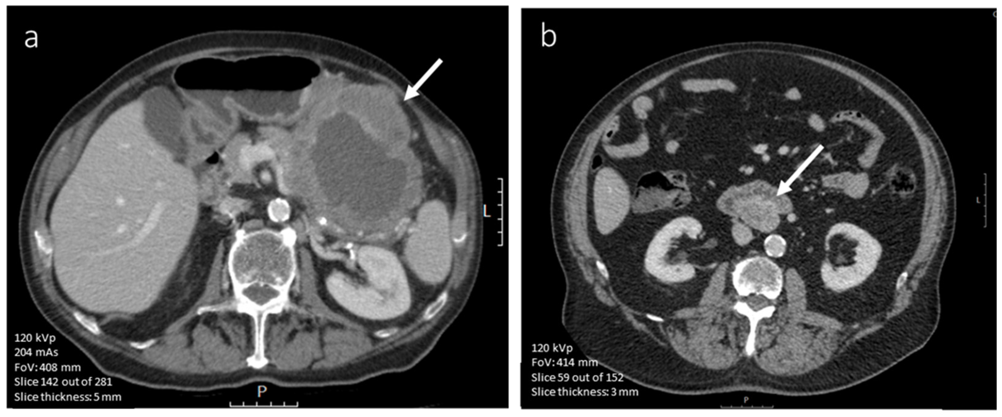 Diagnostics 12 02722 g005 Diagnostics 12 02722 g005