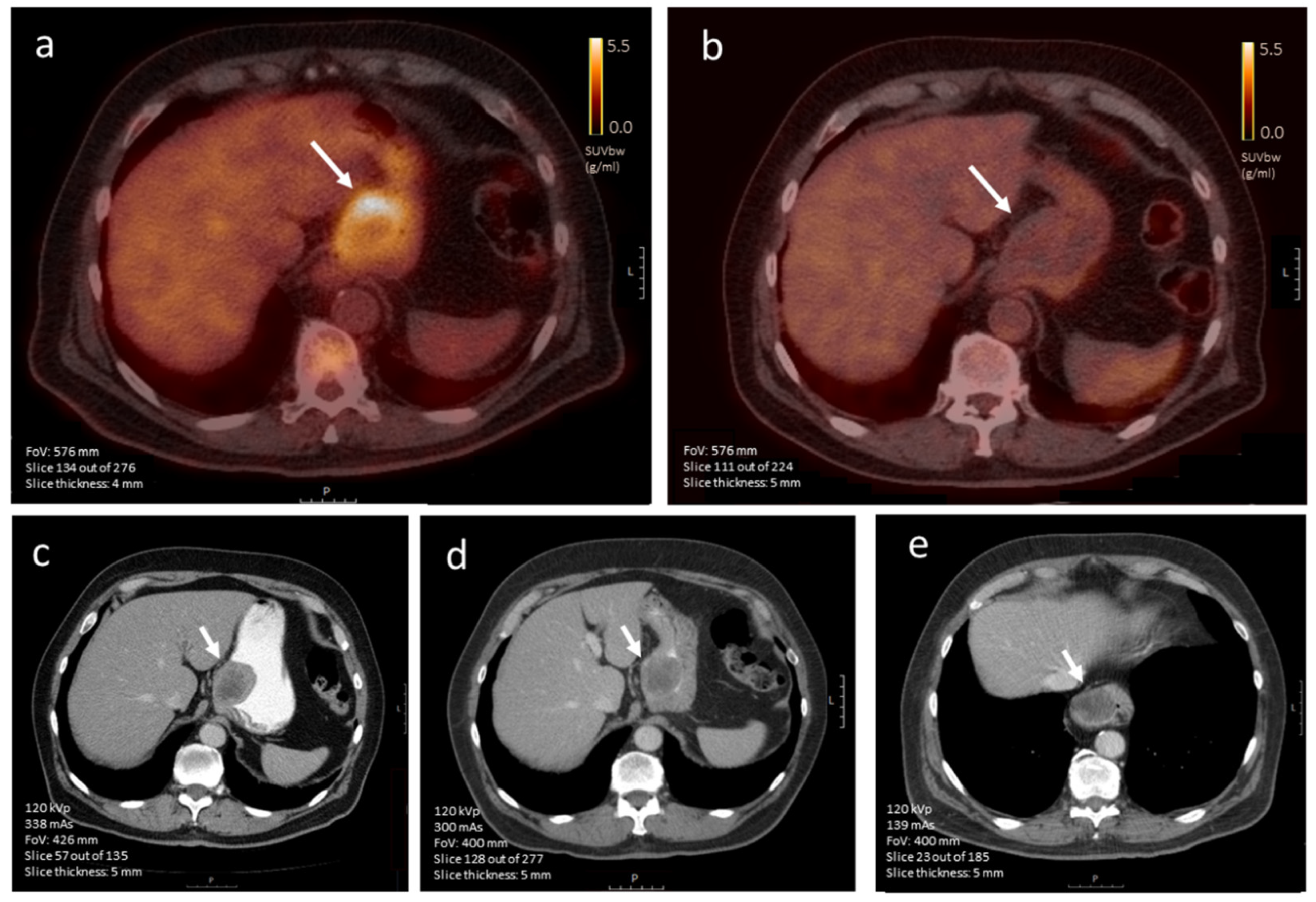 Diagnostics 12 02722 g007 Diagnostics 12 02722 g007