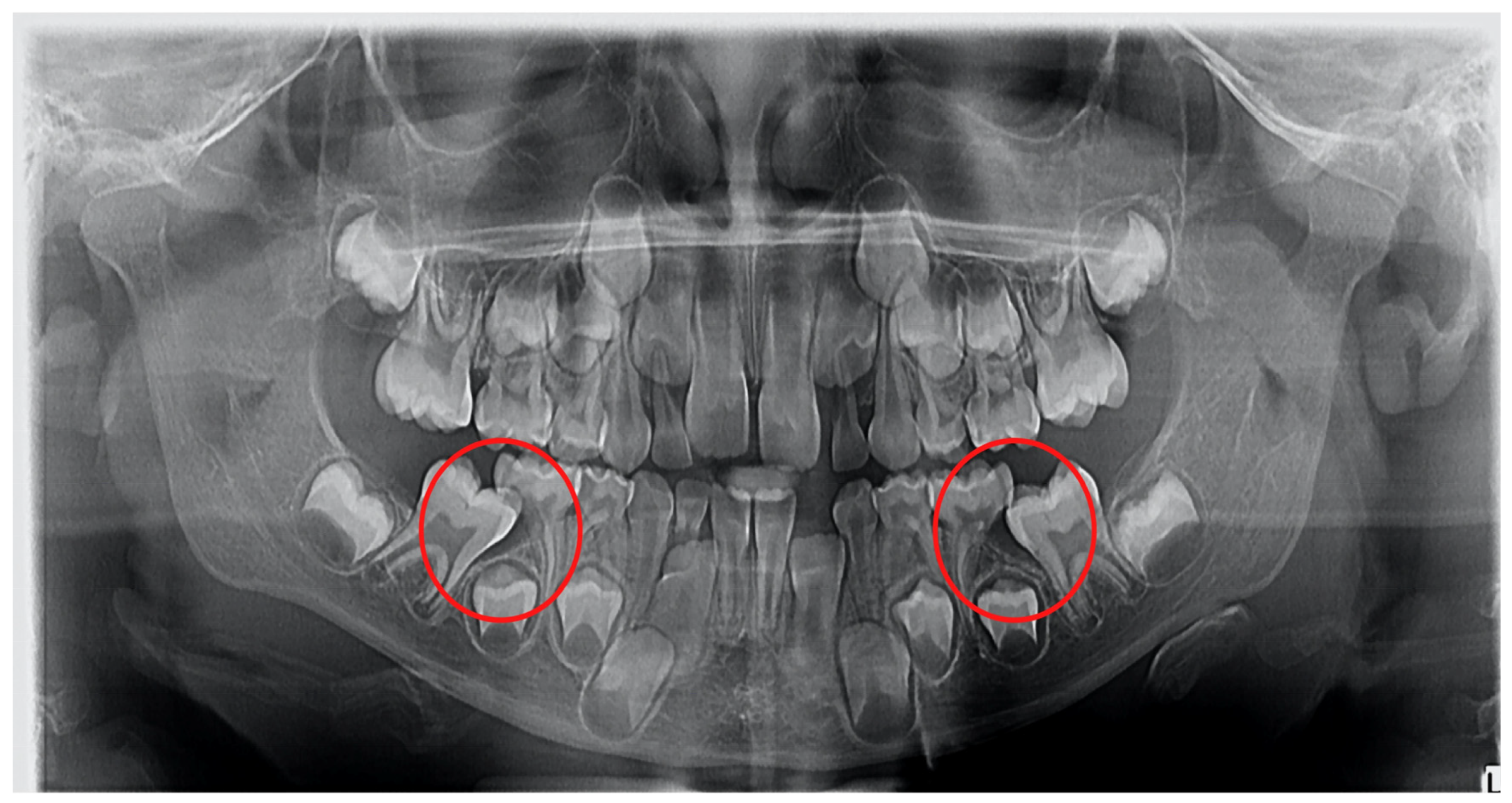 Diagnostics 12 02731 g002 Diagnostics 12 02731 g002