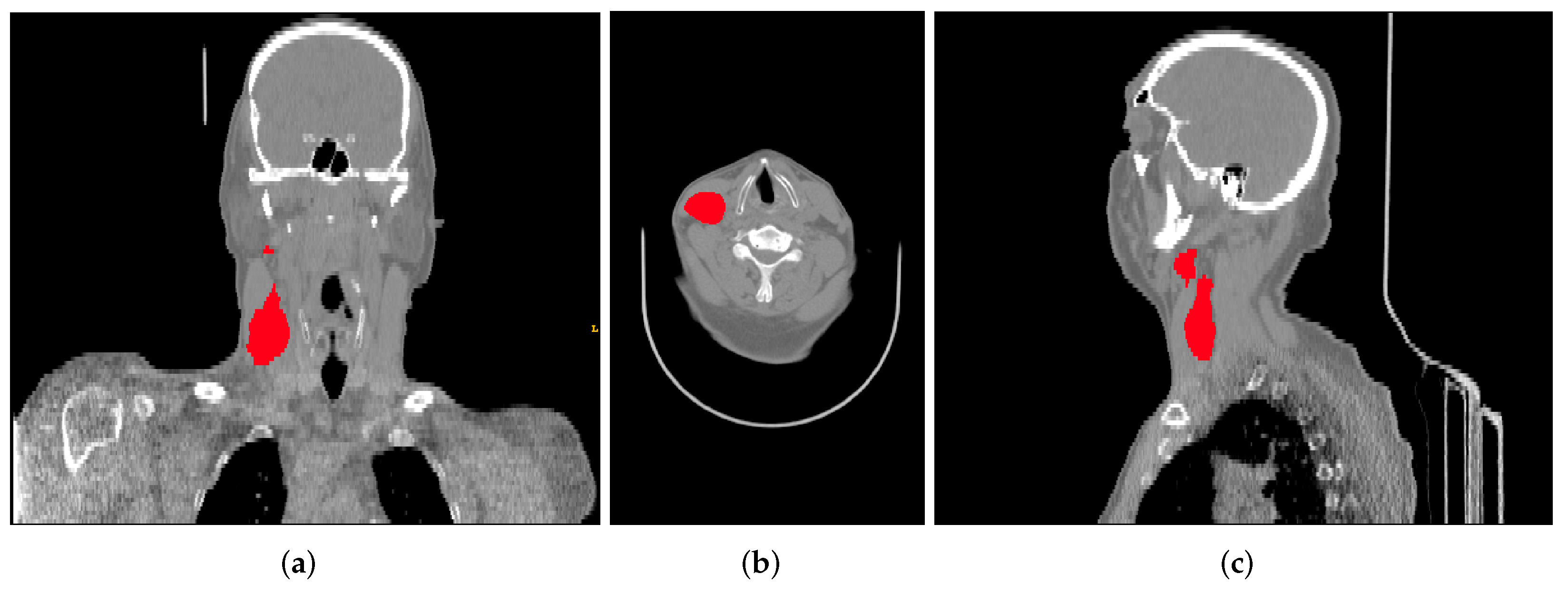Diagnostics 12 02733 g002