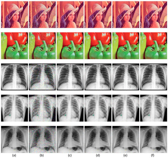 Diagnostics Free FullText New RealTime Impulse Noise Removal
