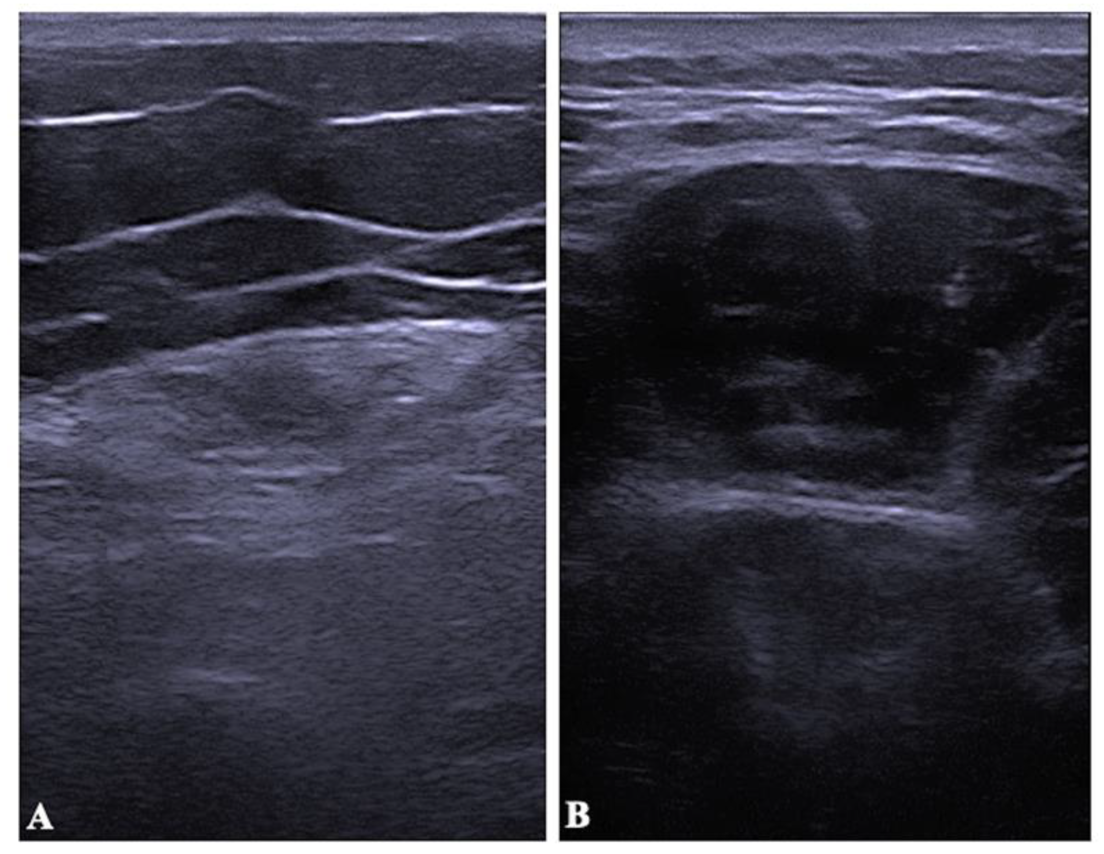 Diagnostics 12 02743 g003 Diagnostics 12 02743 g003