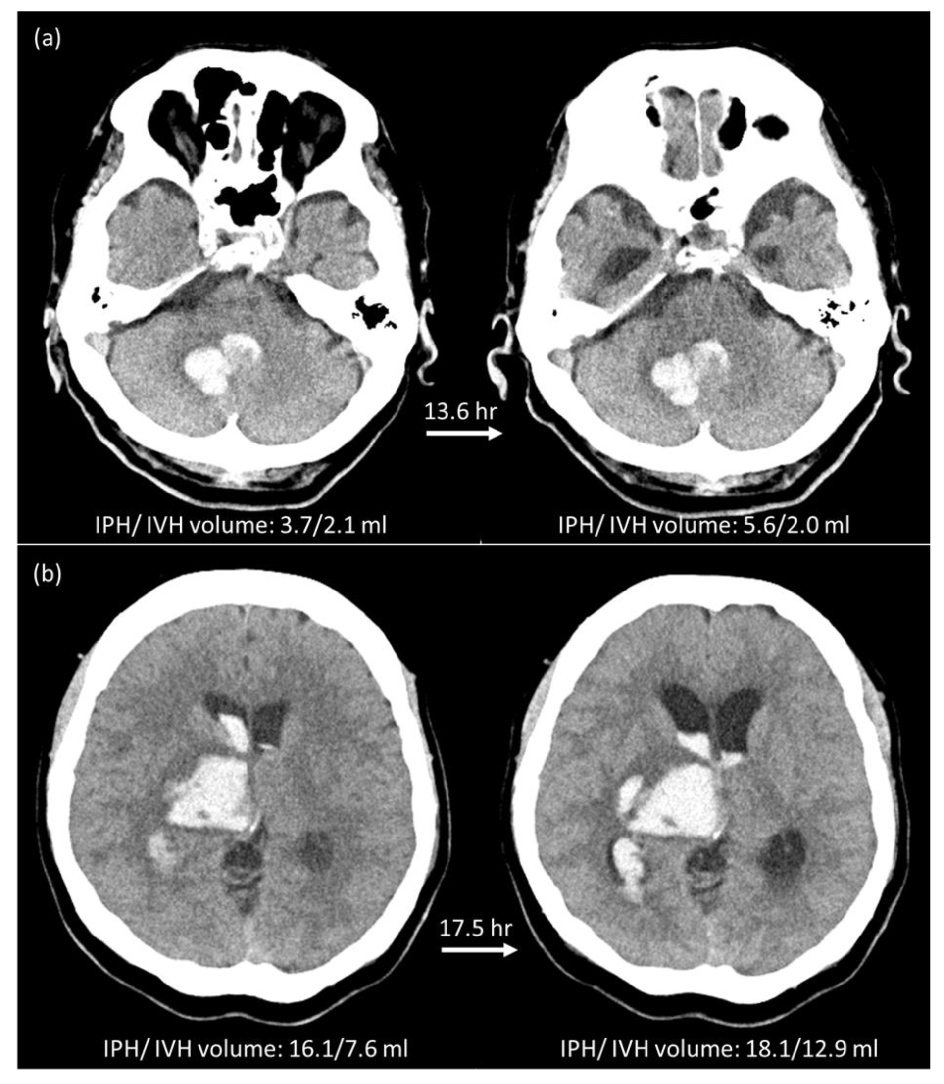 Diagnostics 12 02755 g002 Diagnostics 12 02755 g002