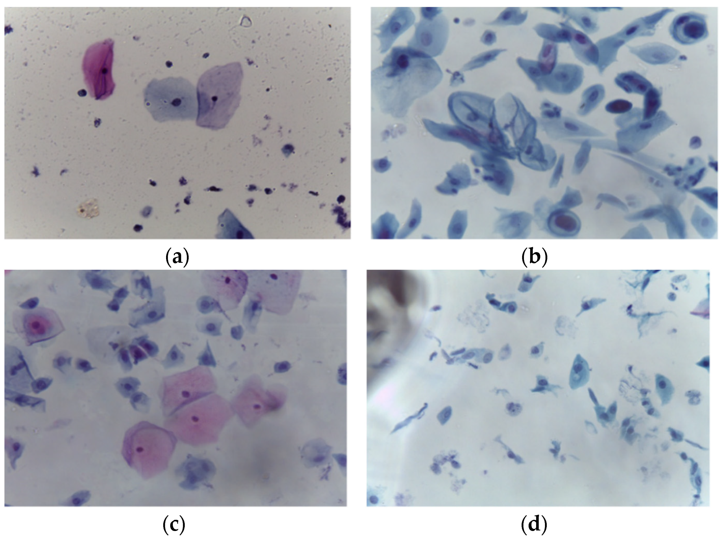 Analysis of Cytology Pap Smear Images Based on Ensemble Deep Learning