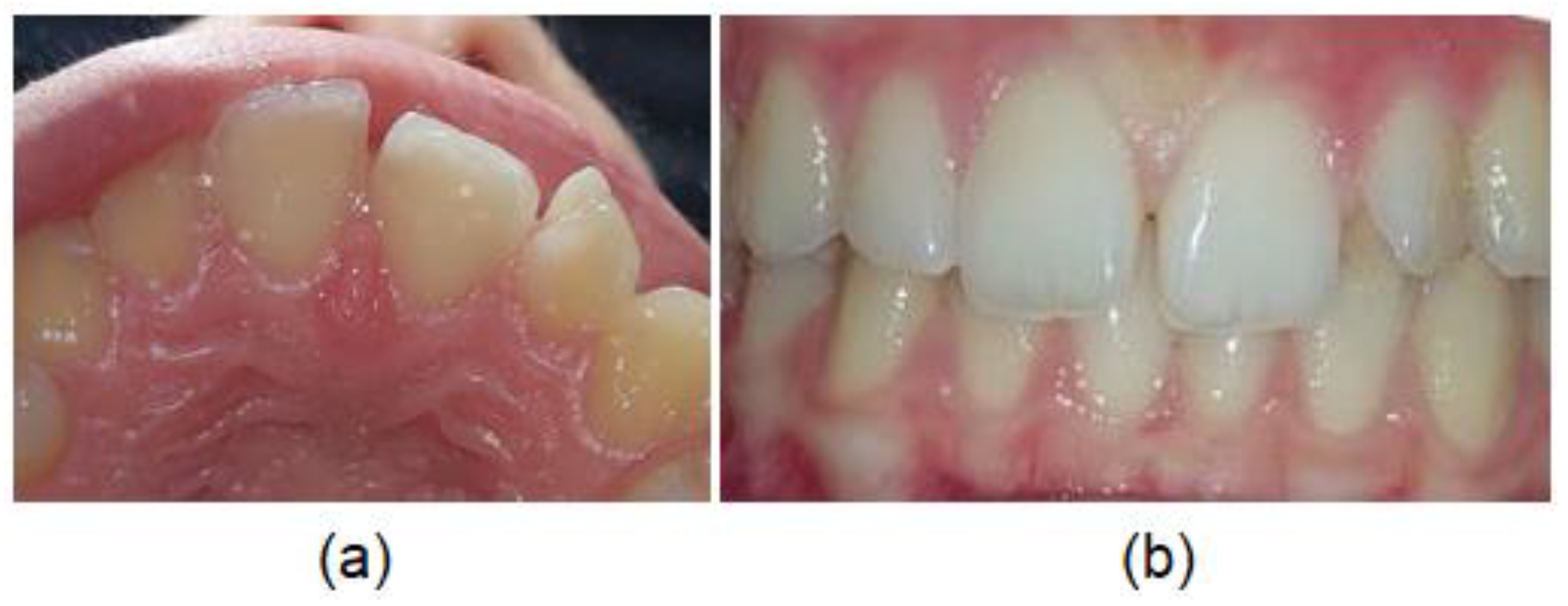 Diagnostics Free FullText Morphological Diversity of Permanent