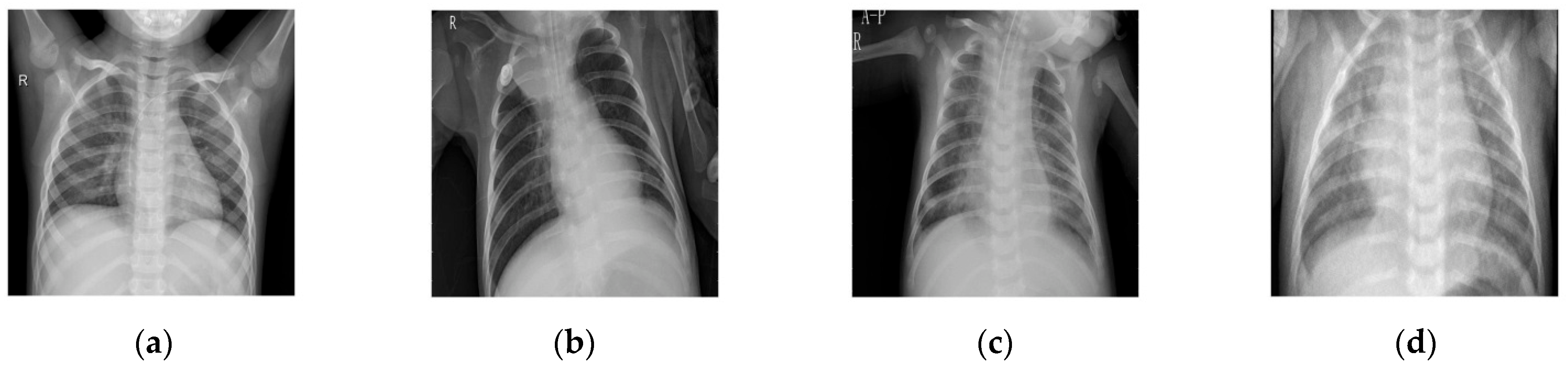 Diagnostics 12 02766 g002 Diagnostics 12 02766 g002