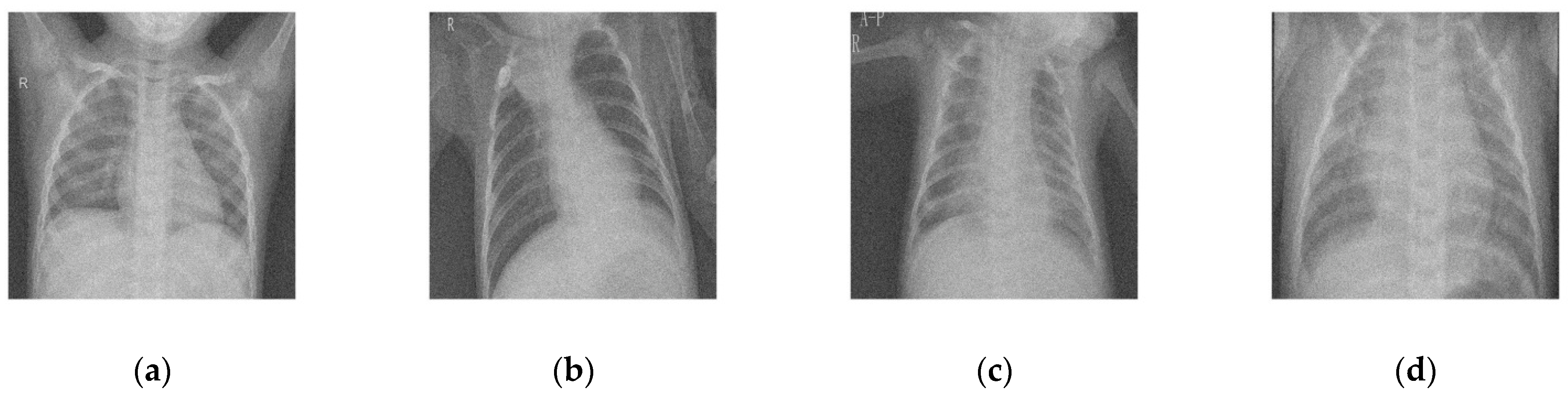 Diagnostics 12 02766 g003 Diagnostics 12 02766 g003