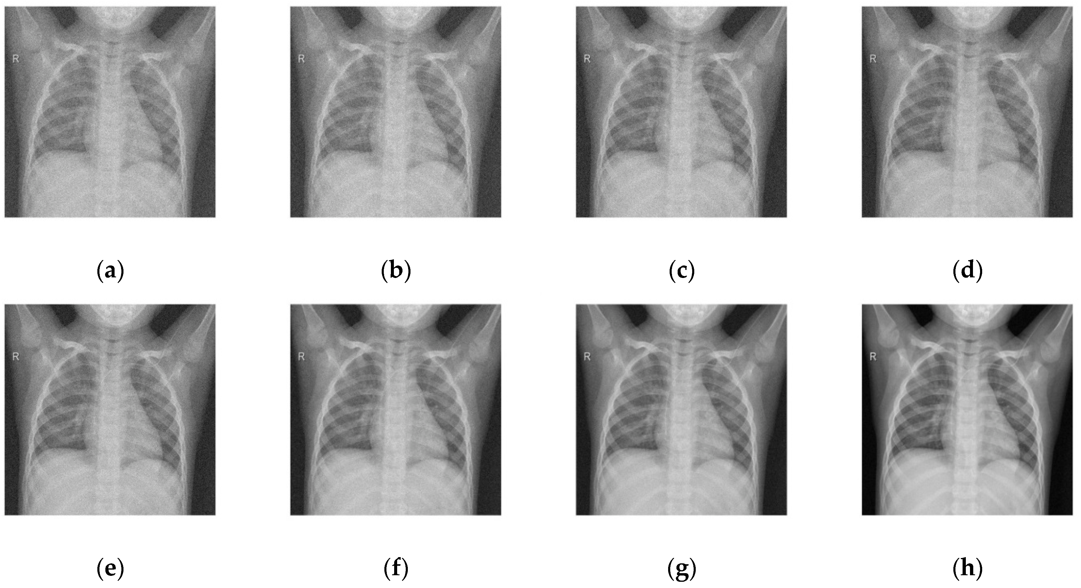Diagnostics 12 02766 g004 Diagnostics 12 02766 g004