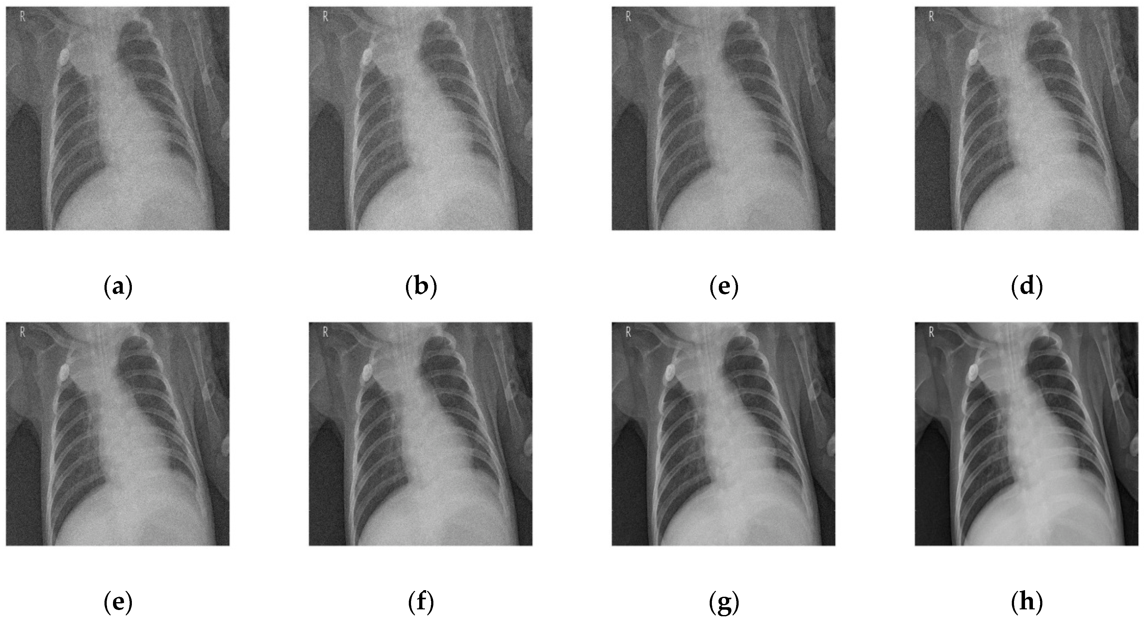 Diagnostics 12 02766 g005 Diagnostics 12 02766 g005